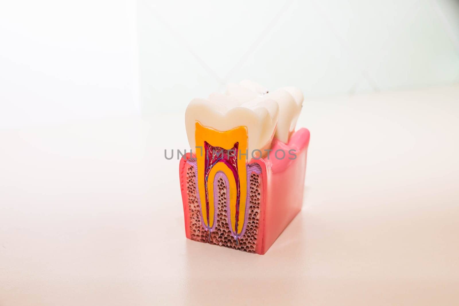 tooth model without caries, tooth decay in dentist's office. Healthy teeth concept . children's dentist. Copy space by YuliaYaspe1979