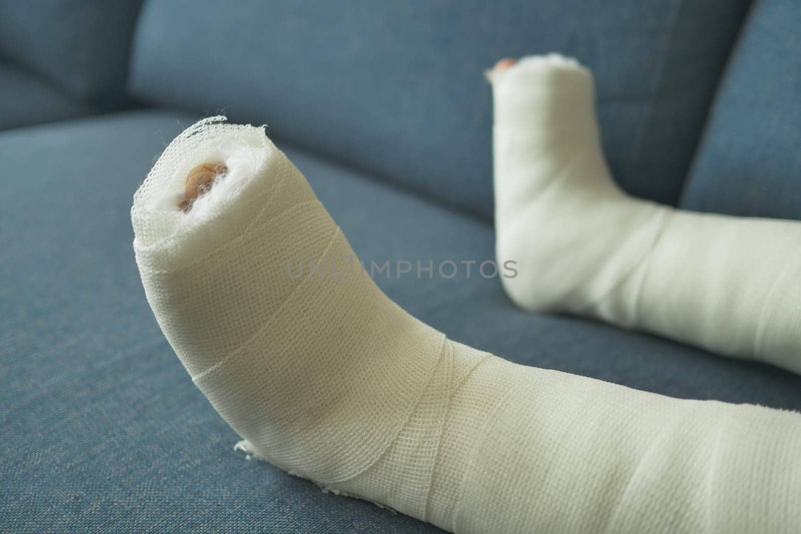 little child boy with plaster bandage on leg