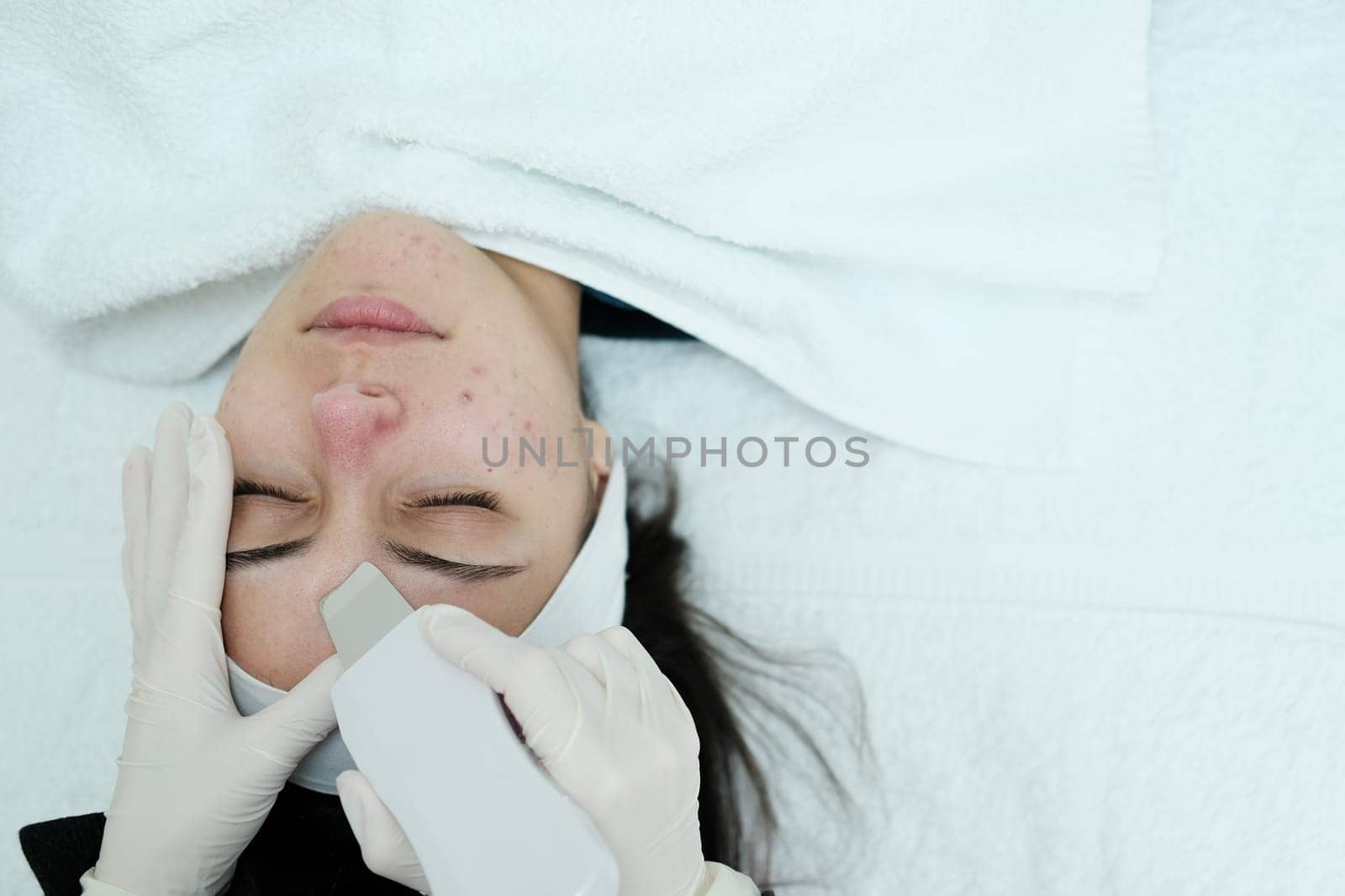 Cosmetologist making a deep facial cleansing with skin scrubber on female patient face. Ultrasound scrubber.
