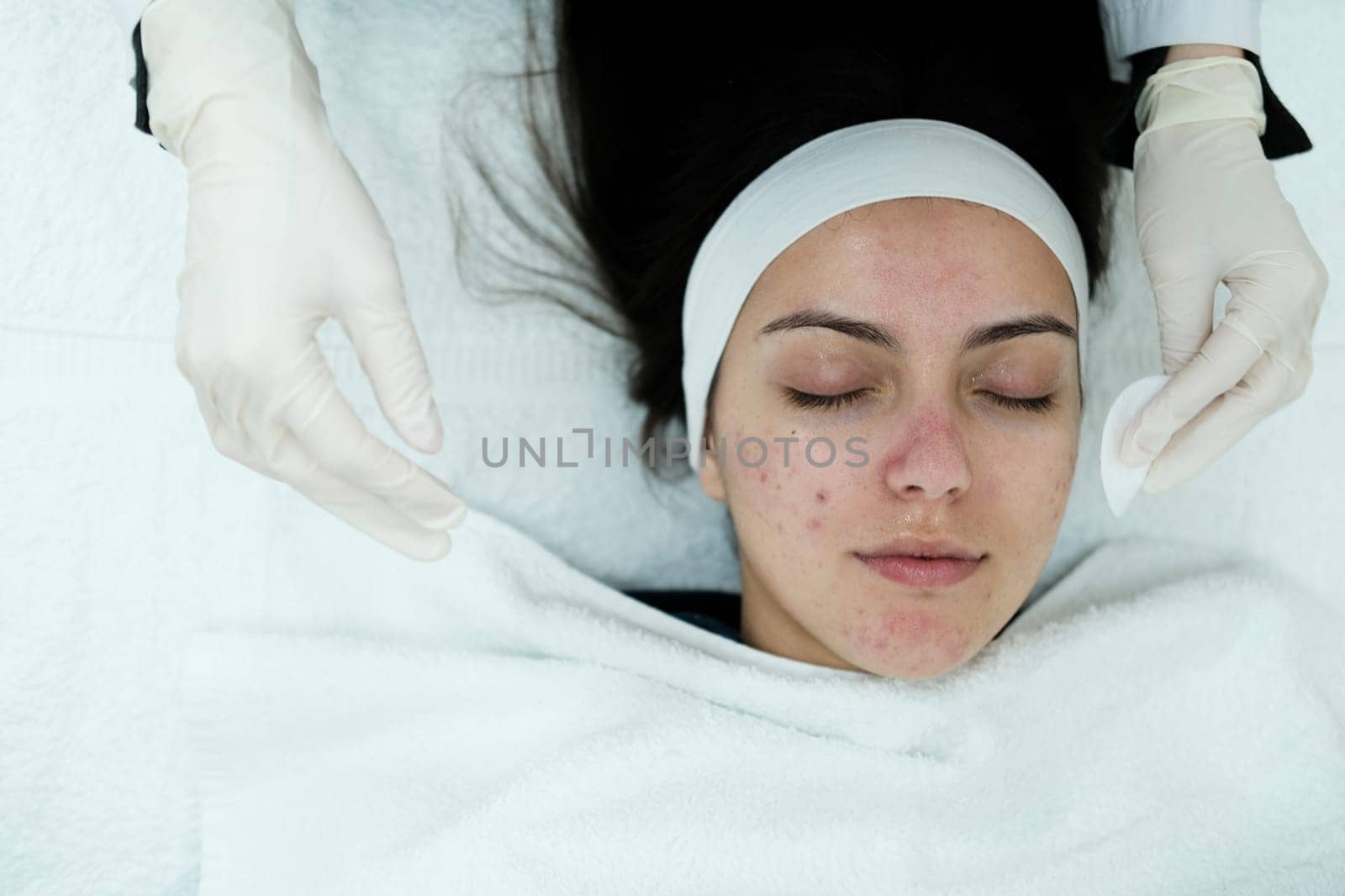 Cosmetologist cleaning face of a patient with a cotton pad. Preparing skin for further treatments.