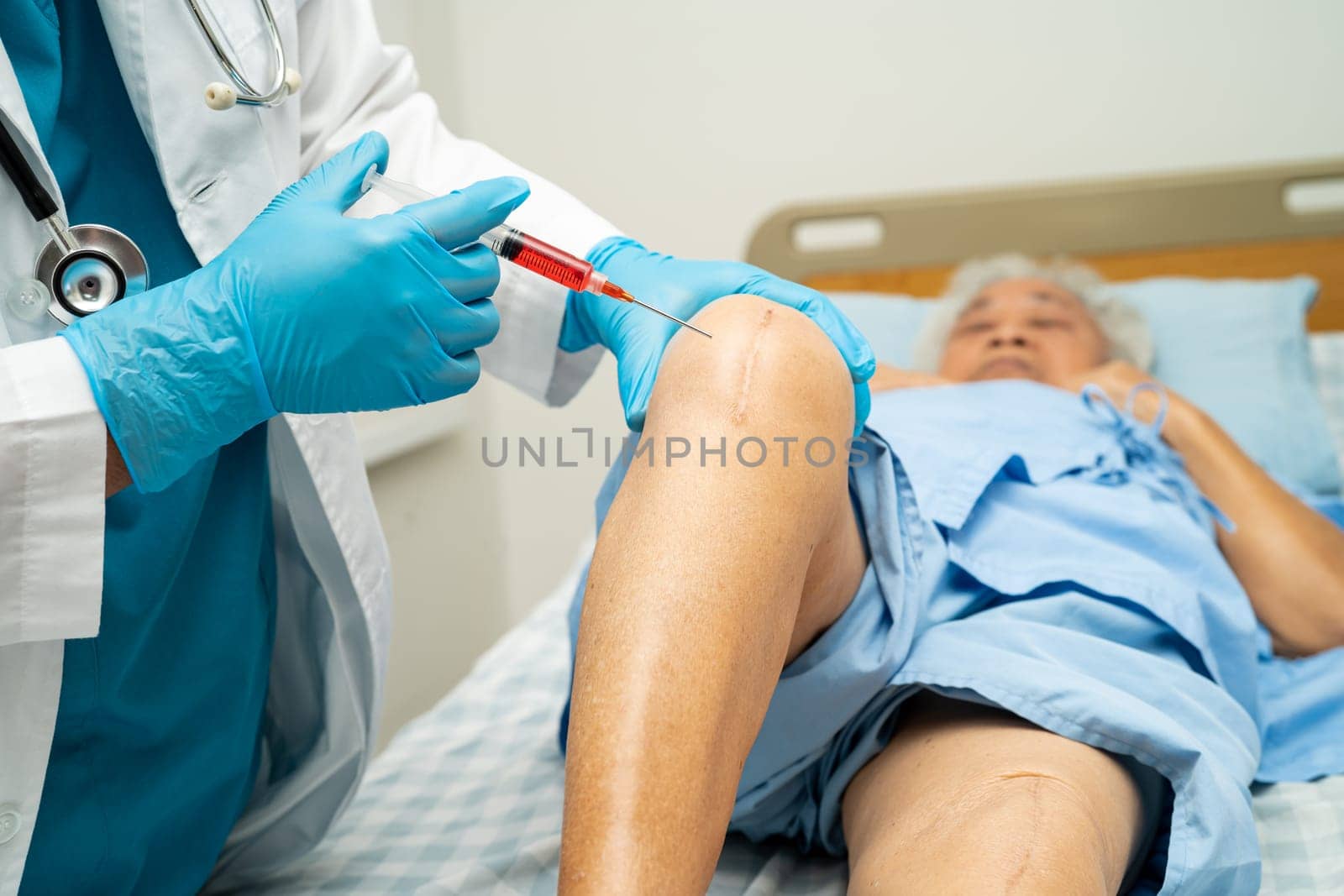 Asian doctor inject Hyaluronic acid platelet rich plasma into the knee of senior woman to walk without pain.