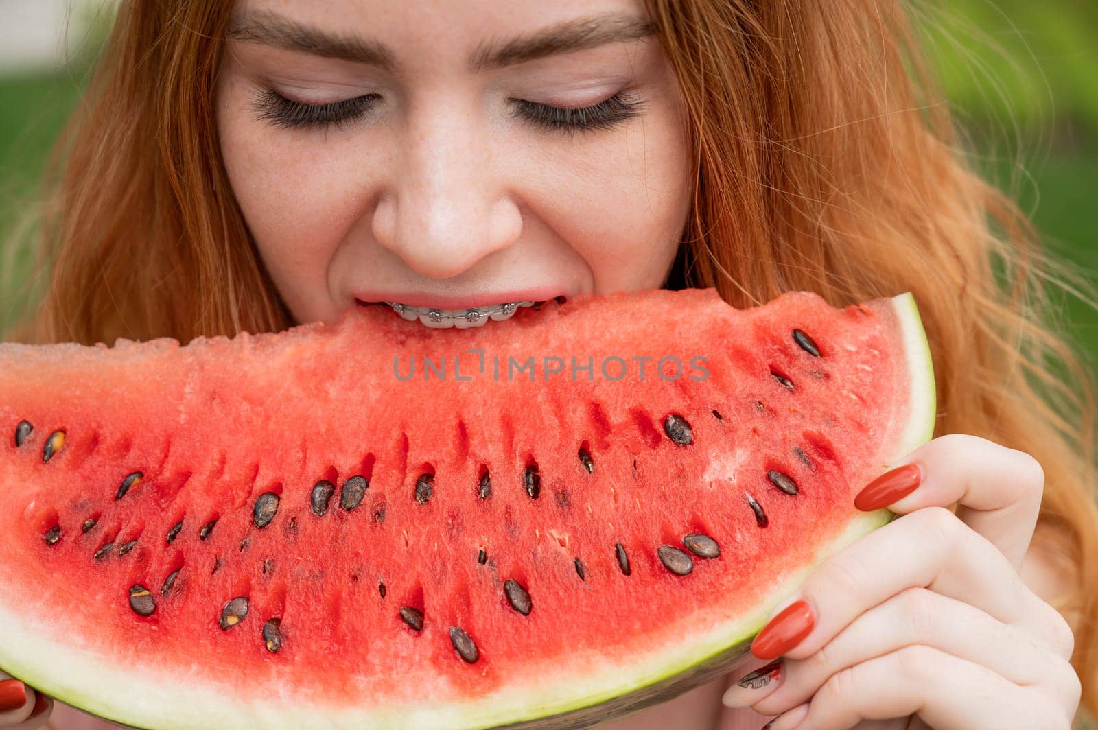 Close-up portrait of red-haired young woman with braces eating watermelon outdoors.