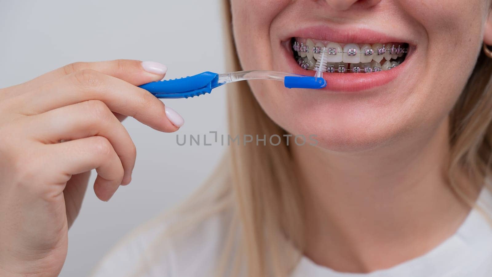 Caucasian woman cleaning her teeth with braces using a brush. Cropped portrait. by mrwed54