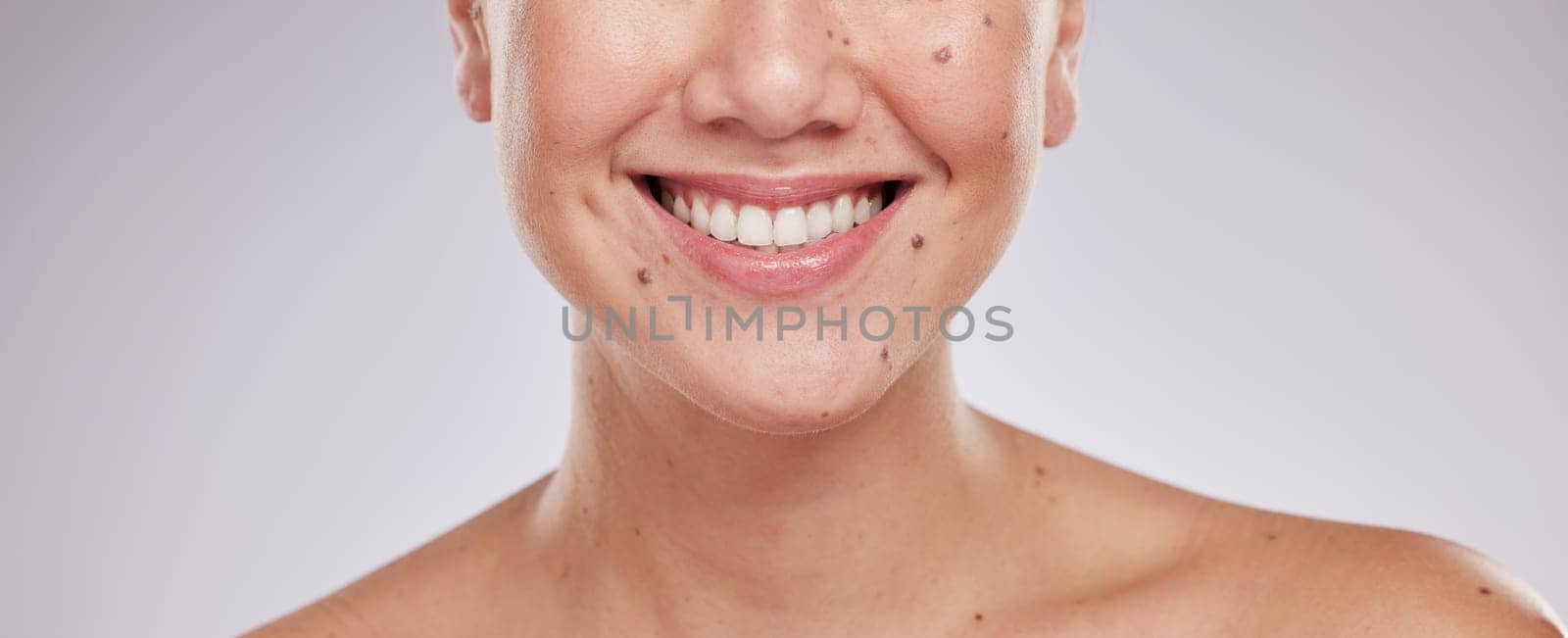 Face smile, dental and teeth of woman in studio isolated on a gray background. Skincare makeup, cosmetics and lips, mouth and oral hygiene of happy female model with veneers, invisalign and wellness. by YuriArcurs