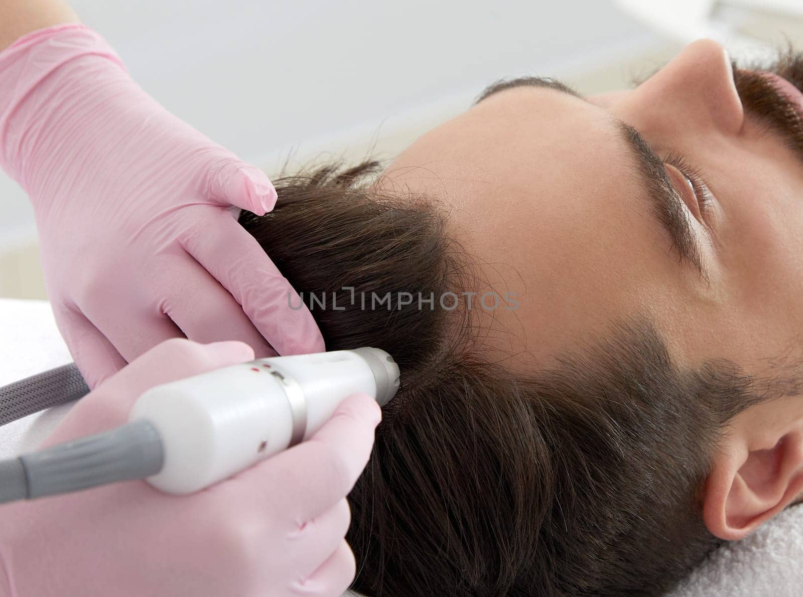 Doctor female dermatologist trichologist makes a procedure to stimulate hair growth on head of a man by Mariakray