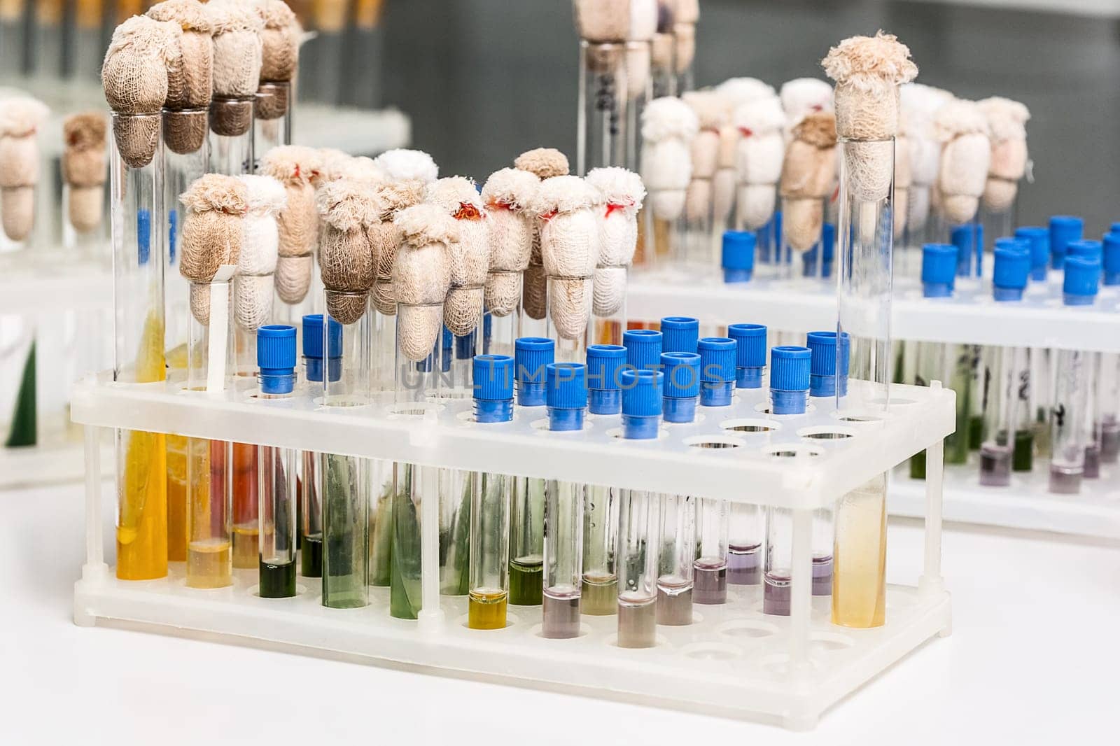 Test-tubes with yellow liquid in the laboratory. Medical research