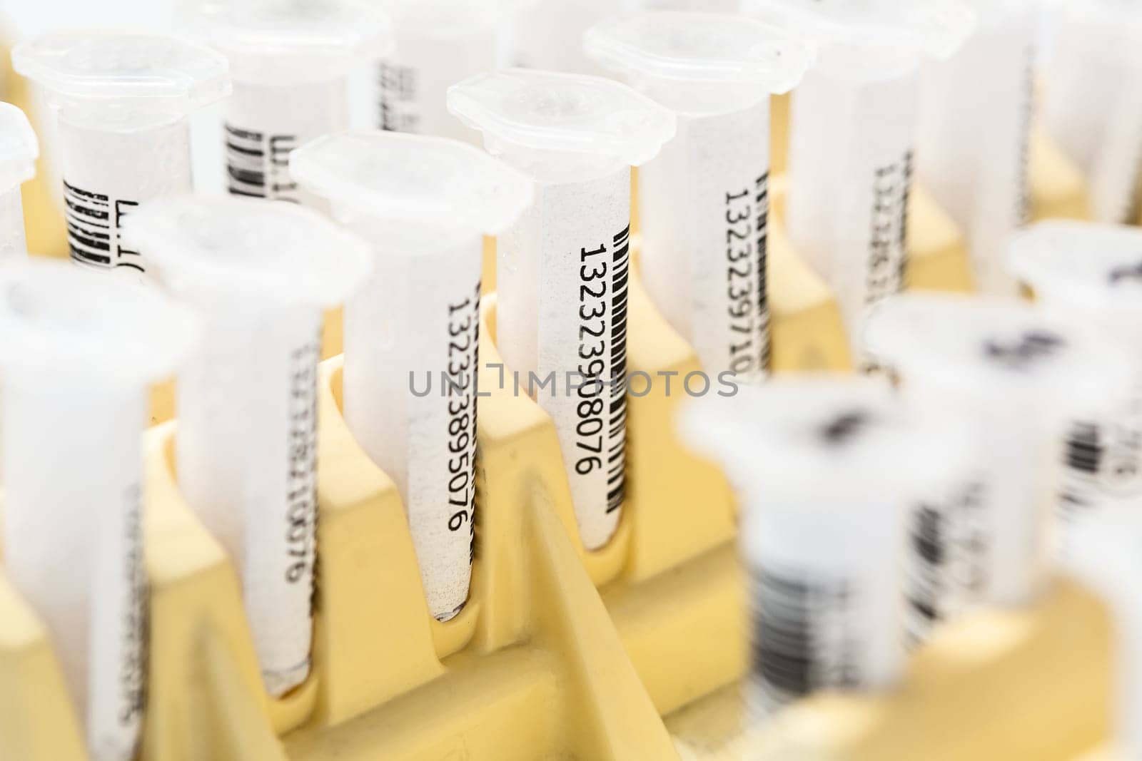 Test tubes arranged on medical trolley. Medical research