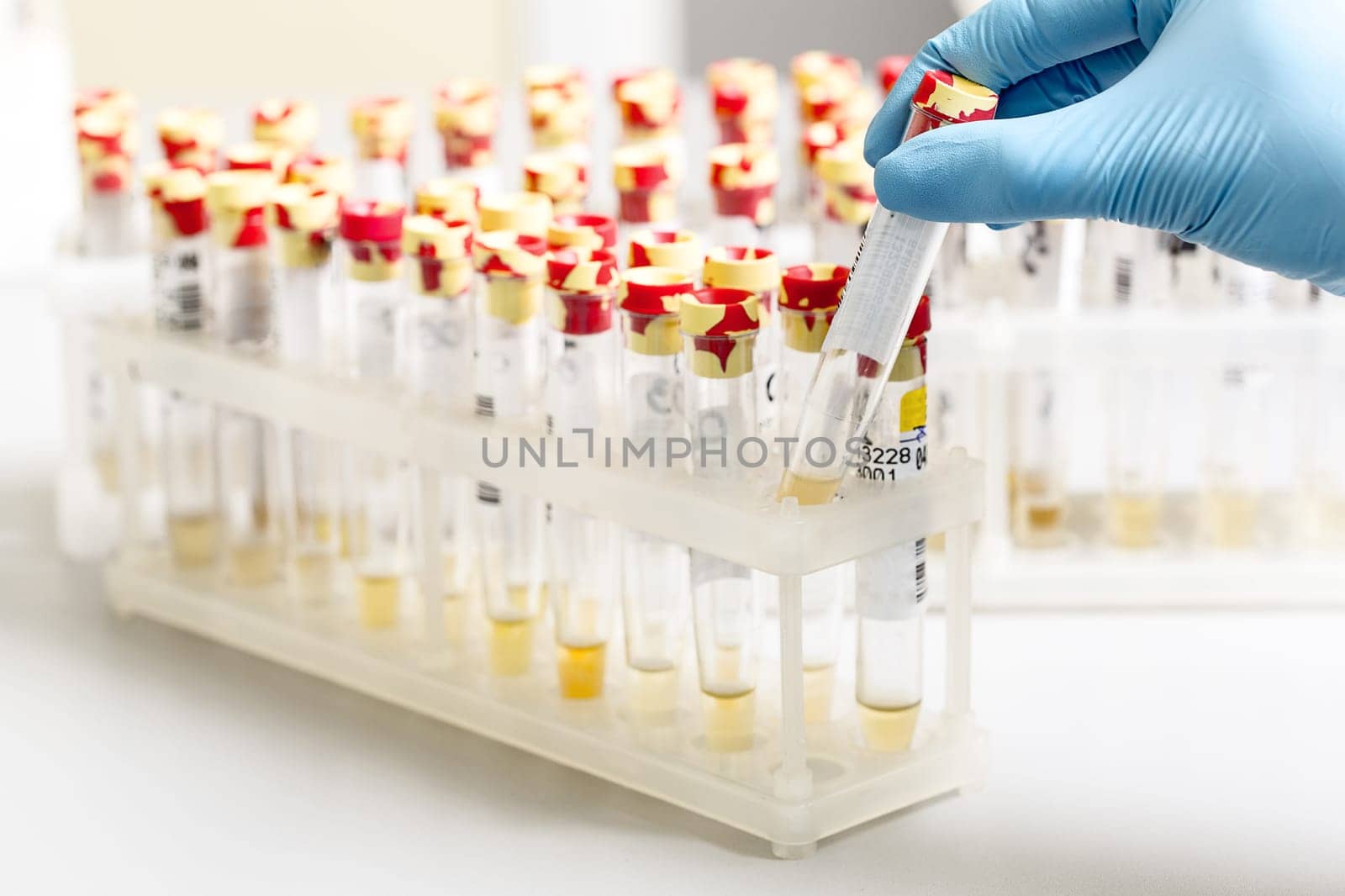 A chemical sample bottle. Centrifuge. A test tube vial sets for analysis. Medical research