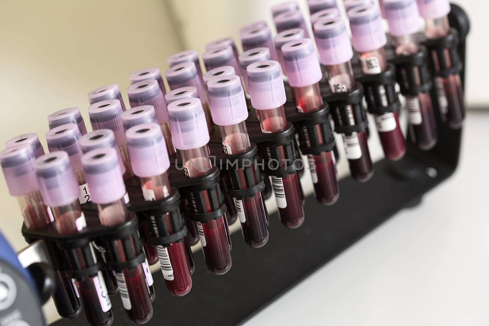 Tube blood sample in a medical examination. Medical research
