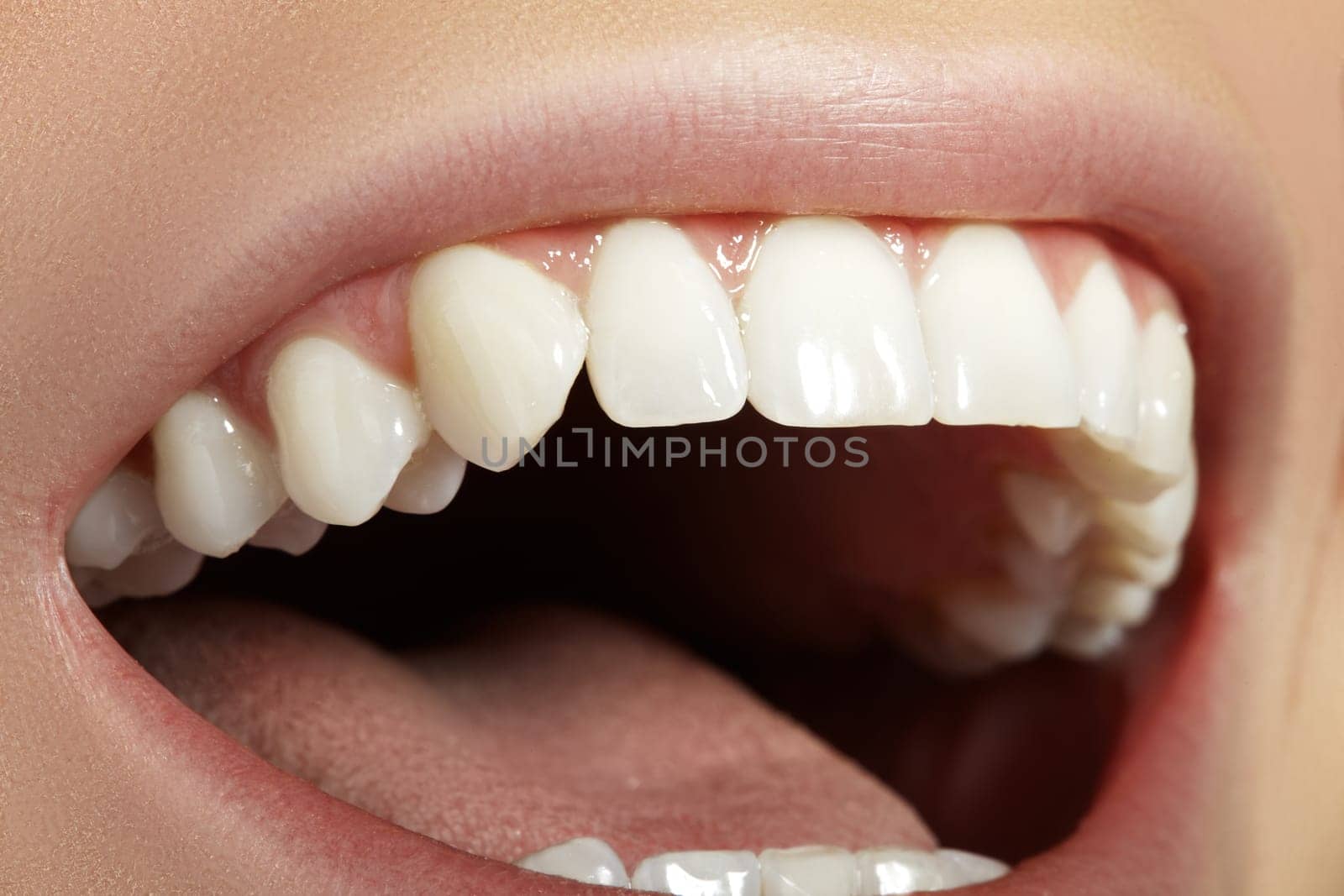 Closeup Dental Beauty. Beautiful Macro Photo of Smile with perfect White Teeth. Sexy Fashion Lips with Natural Make-up. Whitening Tooth and Wellness Treatment