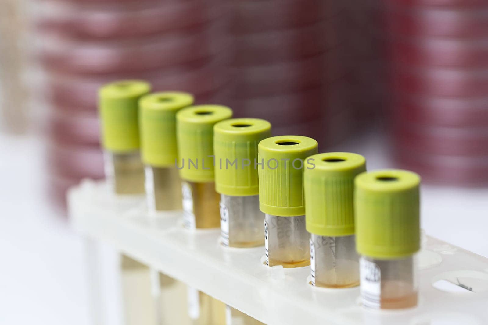 Test-tubes with yellow liquid in the laboratory. Medical research