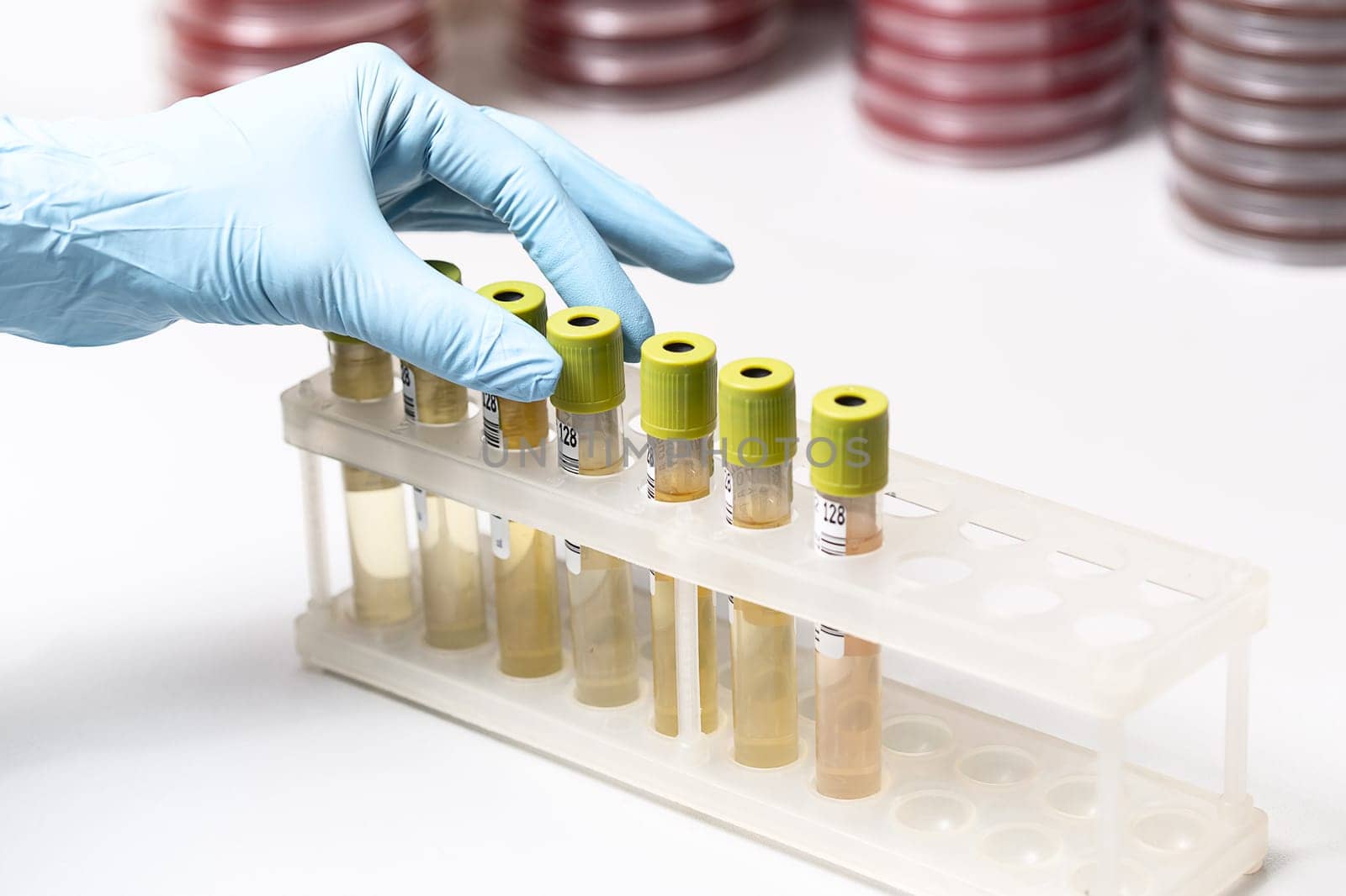 Test-tubes with yellow liquid in the laboratory. Medical research