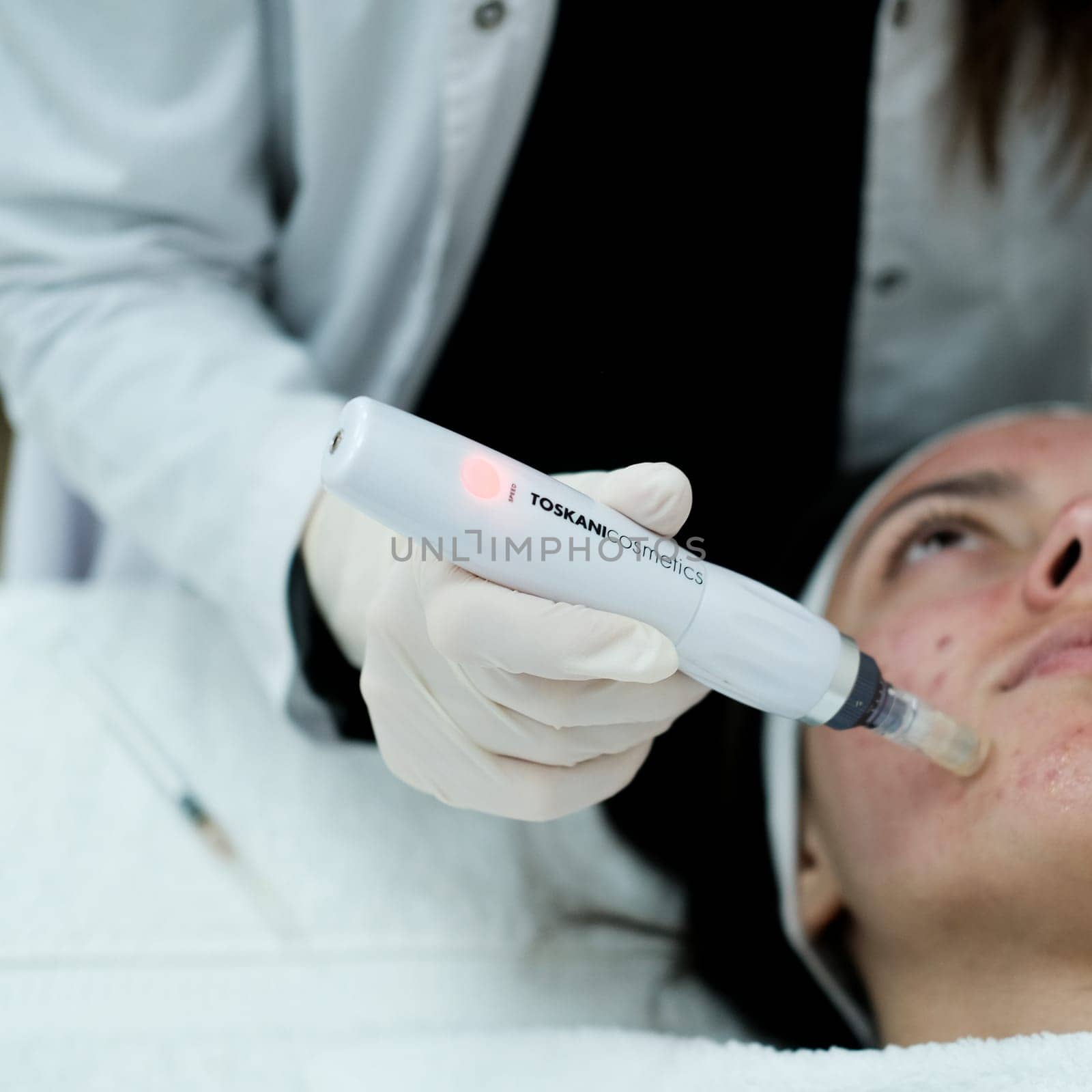 Closeup view of cosmetologist doing microneedling procedure on female patient faceMicroneedling. Dermapen. Esthetician. Health and beauty.