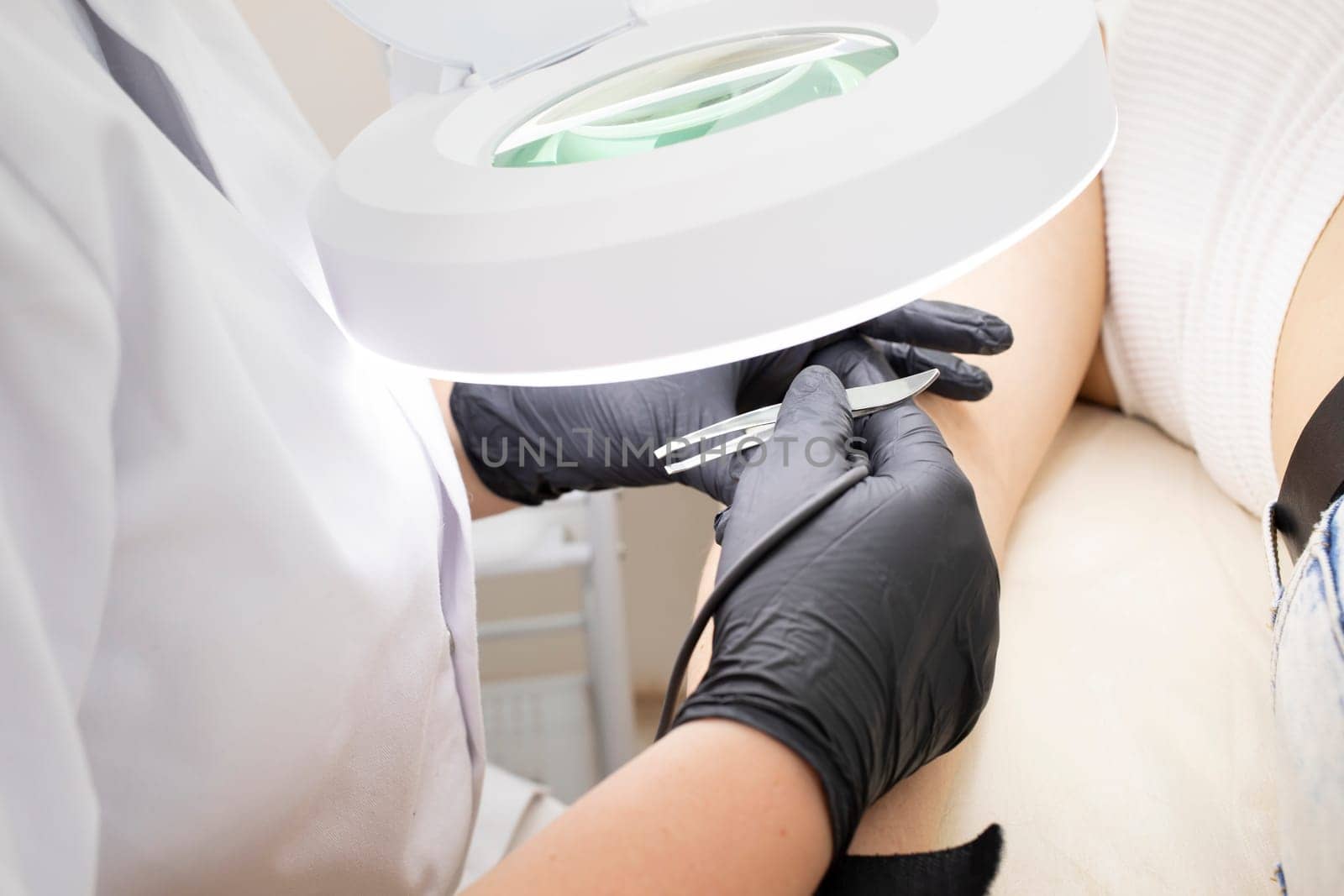 Dermatologist Doing Hair Removal Procedure With Electrolysis On Hand Of White Young Patient, Electric Epilation In Beauty Salon. Horizontal Plane. Authentic High quality photo