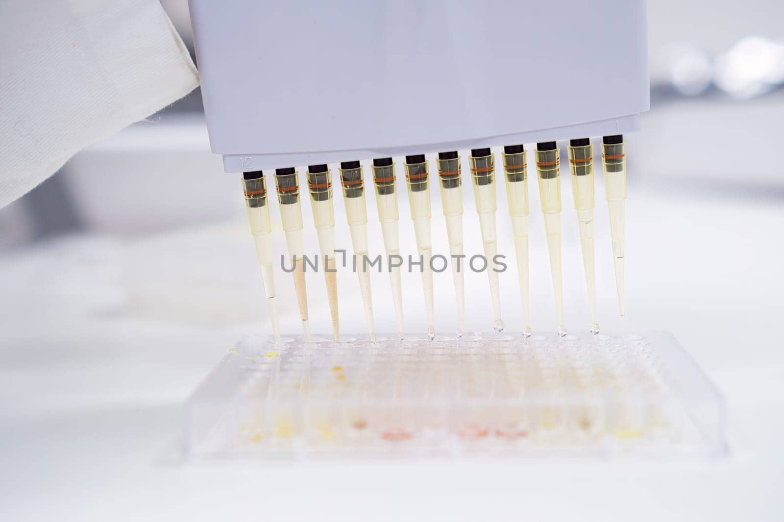 The filling of microplates for blood test testing is accomplished by scientist using a multichannel pipette dispenser.
