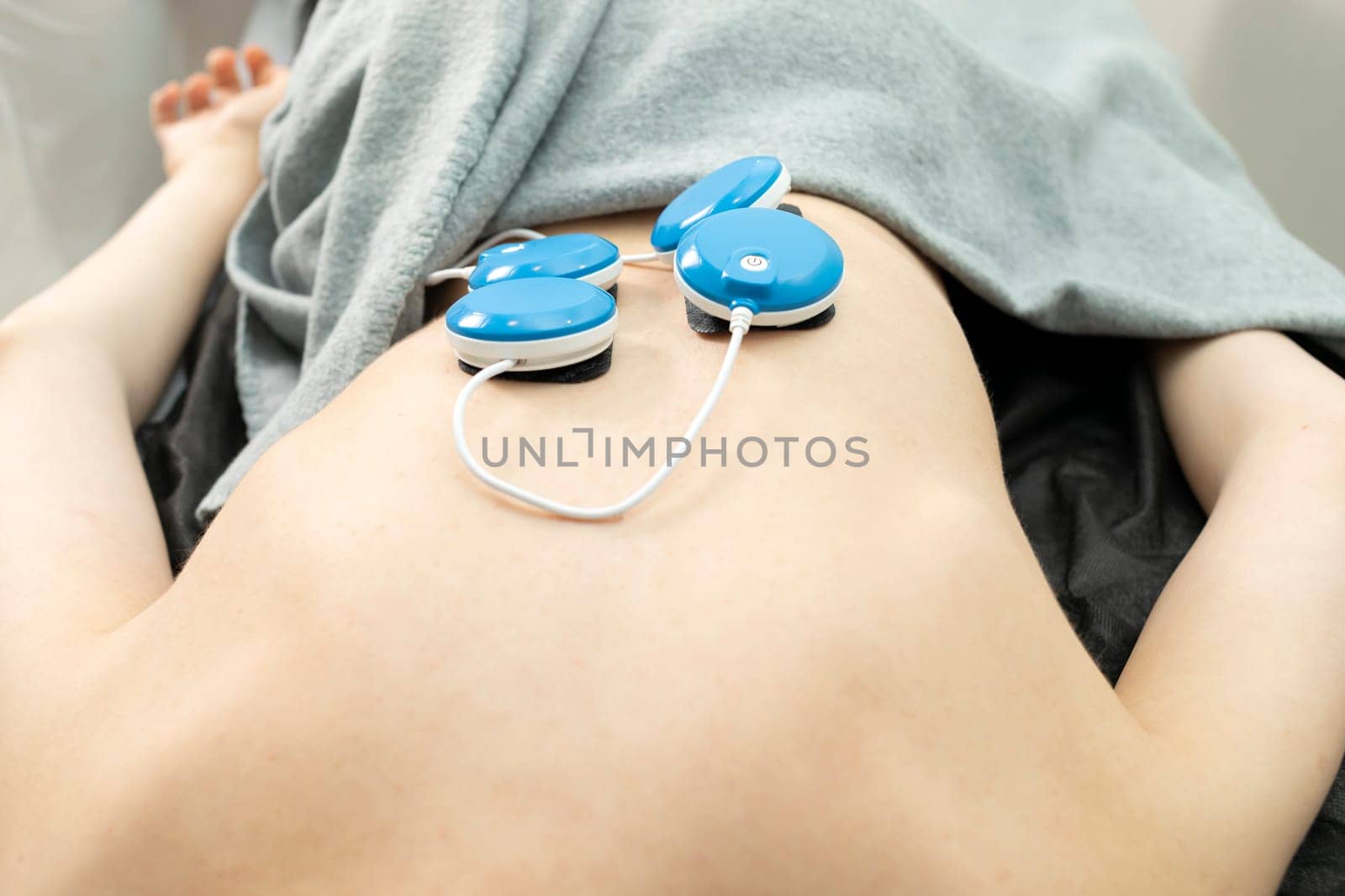 Caucasian Patient With Cerebral Palsy, Scoliosis Lying on Couch, Wireless Electric Muscle Stimulator Massaging Woman's Back, Pain Treatment. Rehabilitation, Medical Equipment. Vertical plane