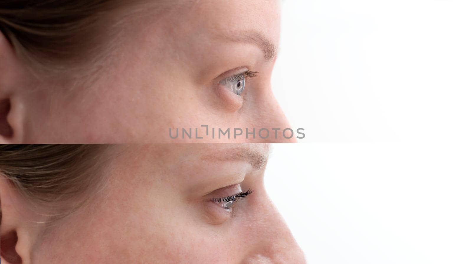 Before And After Eyelashes Lamination Of Caucasian Beautiful Young Woman, Closeup. Profile Side. Horizontal Plane by netatsi