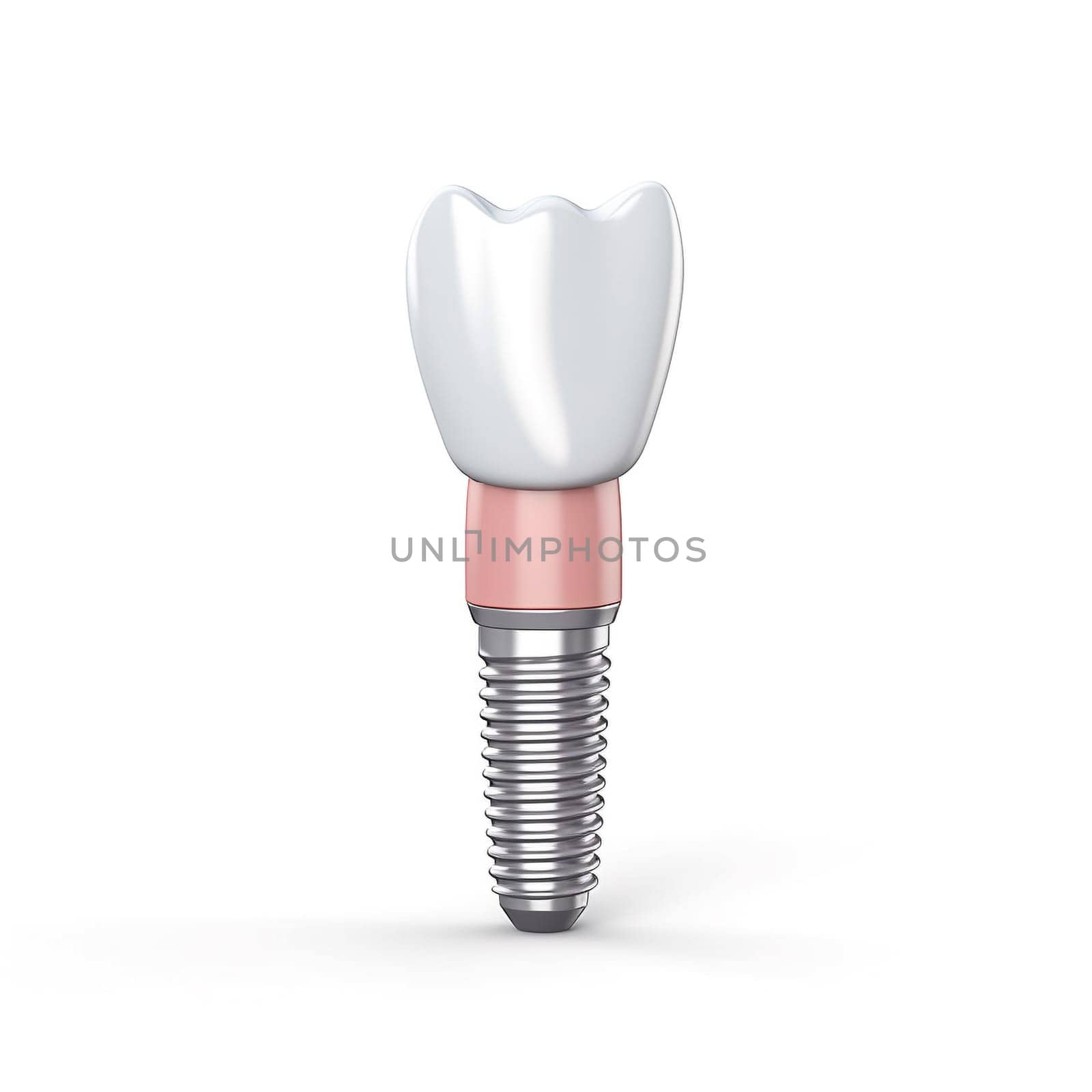Close up of dental teeth implant. 3D rendering. by sarymsakov
