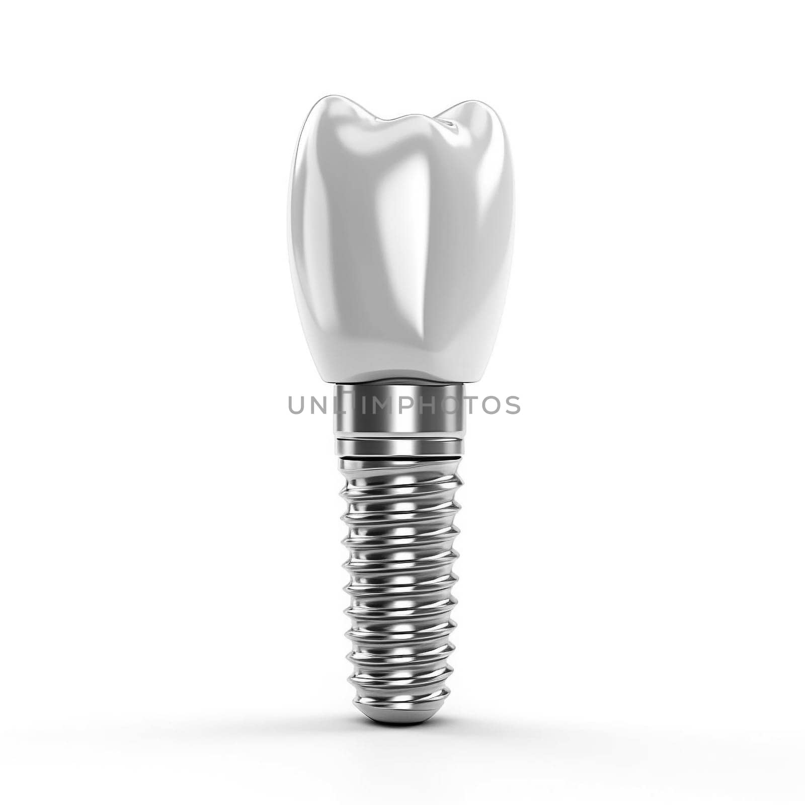 3D illustration of tooth implant on white background, dental concept
