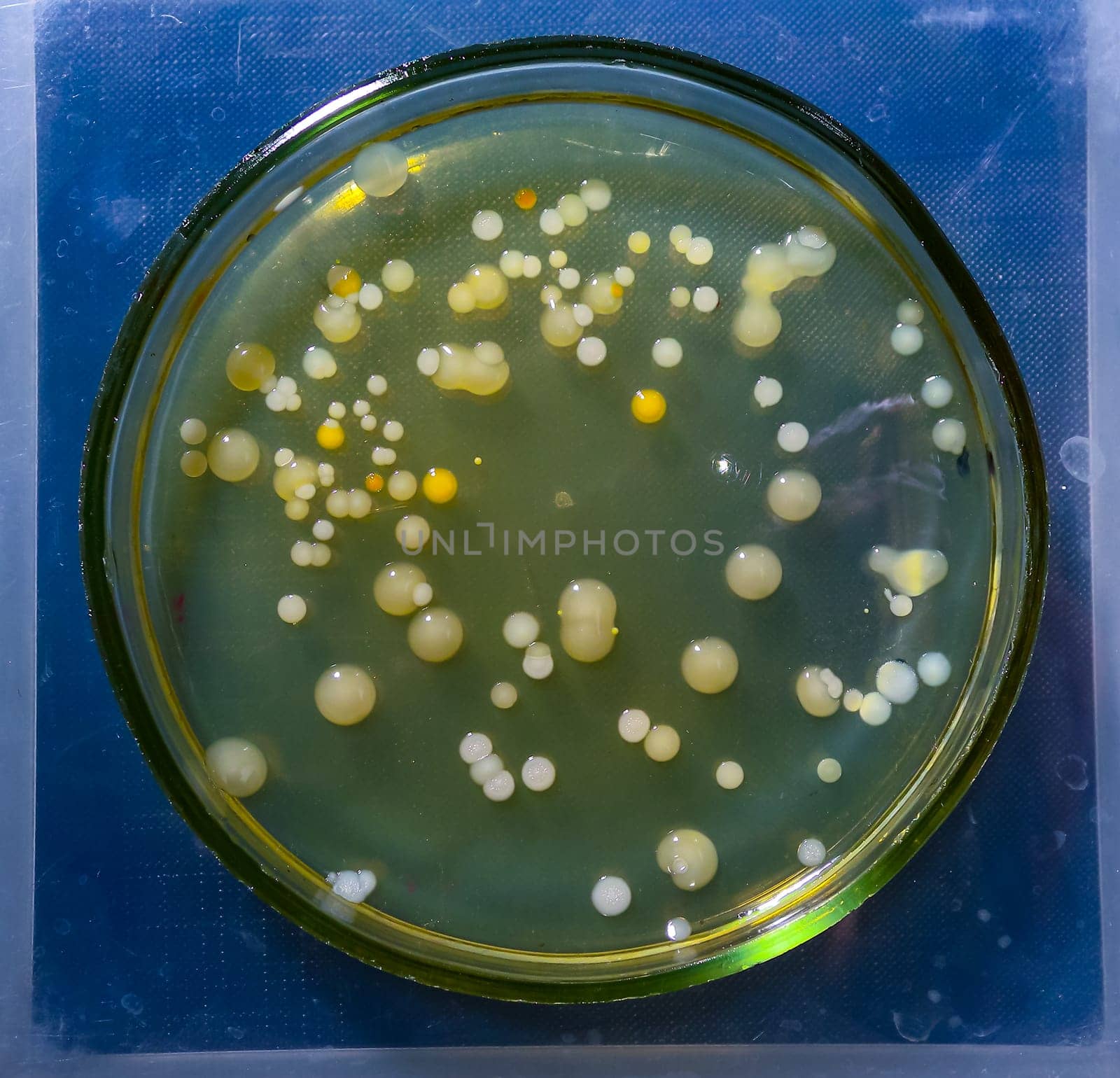 Colonies of pathogenic bacteria in a Petri dish, microbiological studies by Hydrobiolog