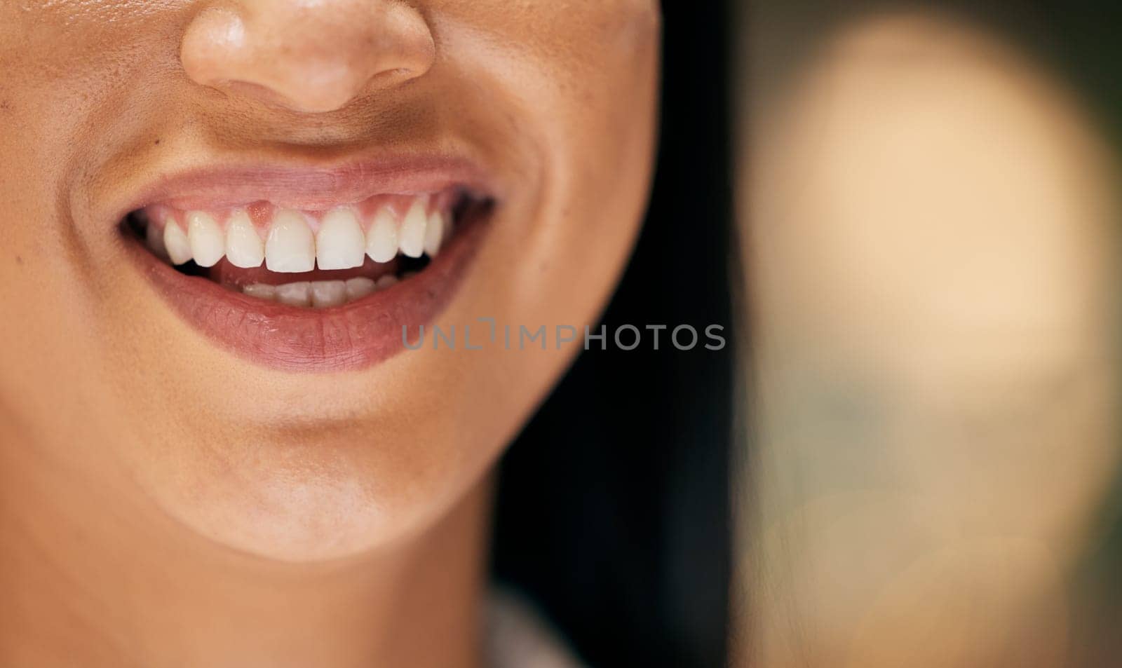 Smile, mouth and face macro of woman inside for happiness, beauty and wellness for friendly dentist. Healthcare, dental care and zoom of happy girl with big smile, healthy teeth and natural skin.