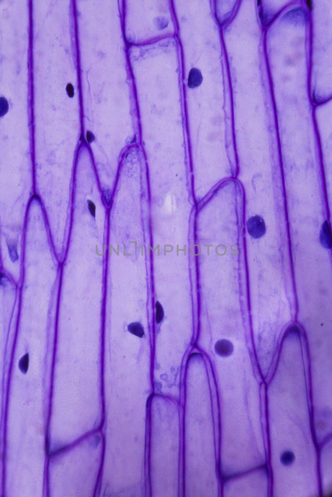 Purple onion peel under the microscope.