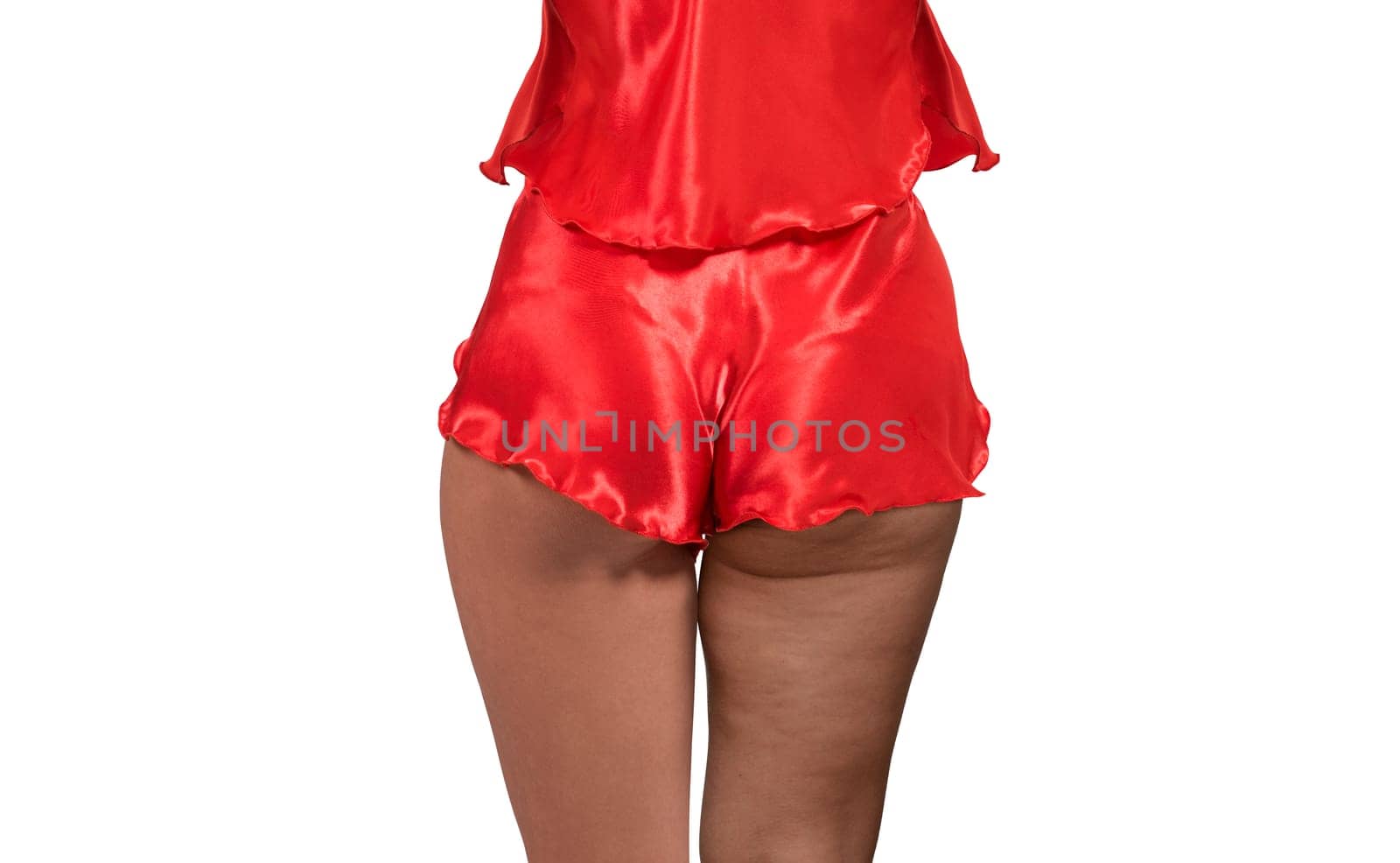 Woman's thighs and buttocks with cellulite. Before and after treatment. Concept of excess weight, diet, sports and needing Improving the skin on legs