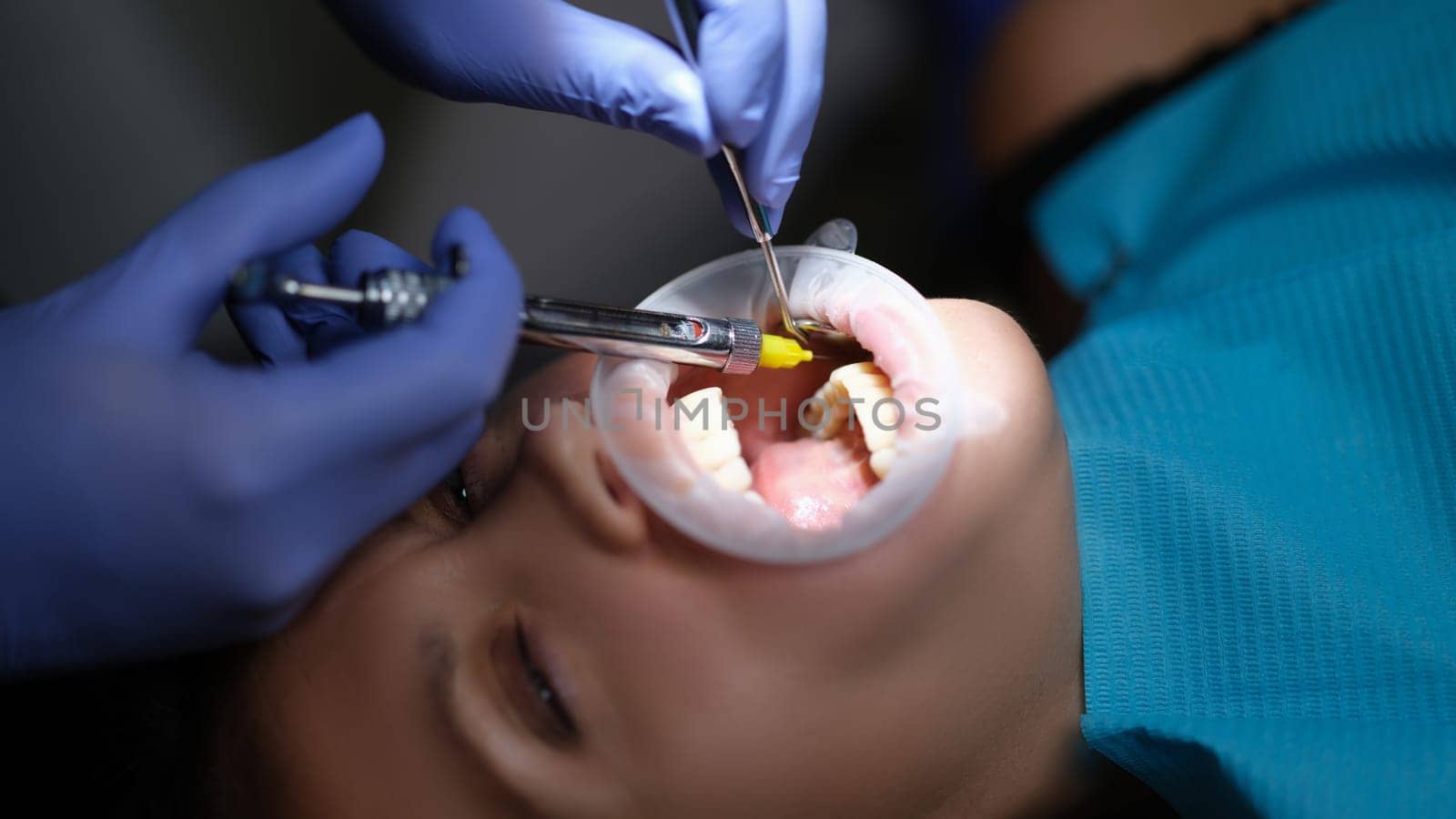 Dentist injecting anesthetic into patient gum for painless dental treatment closeup by kuprevich