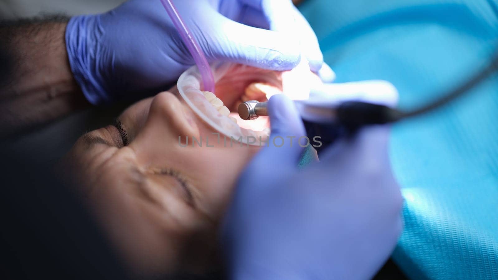 Dentist treating teeth with machine and tools closeup. Dental care concept