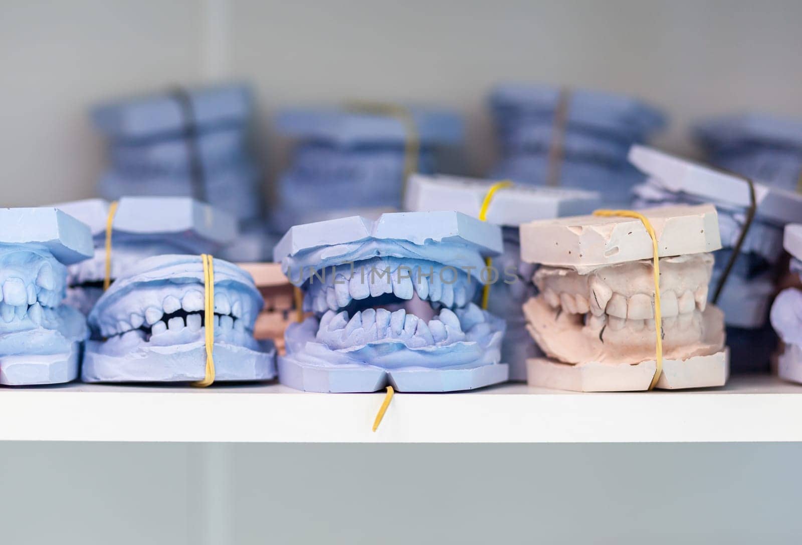 Shelf with lying on her casts of teeth and prosthetic and restorations by AnatoliiFoto