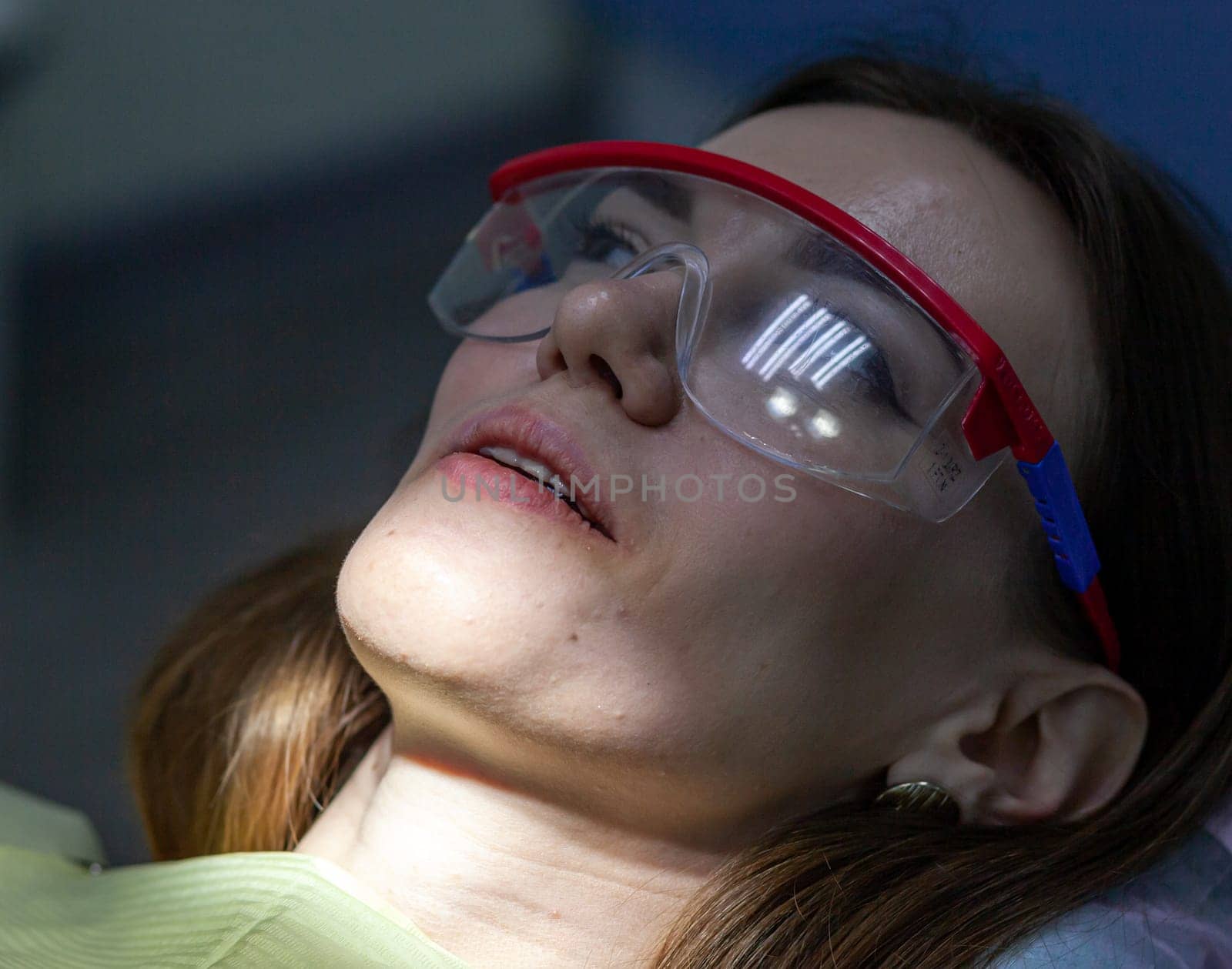 The process of removing braces. A beautiful woman in protective glasses in a dental chair during the procedure of removing braces from teeth. Dentist and assistant working.