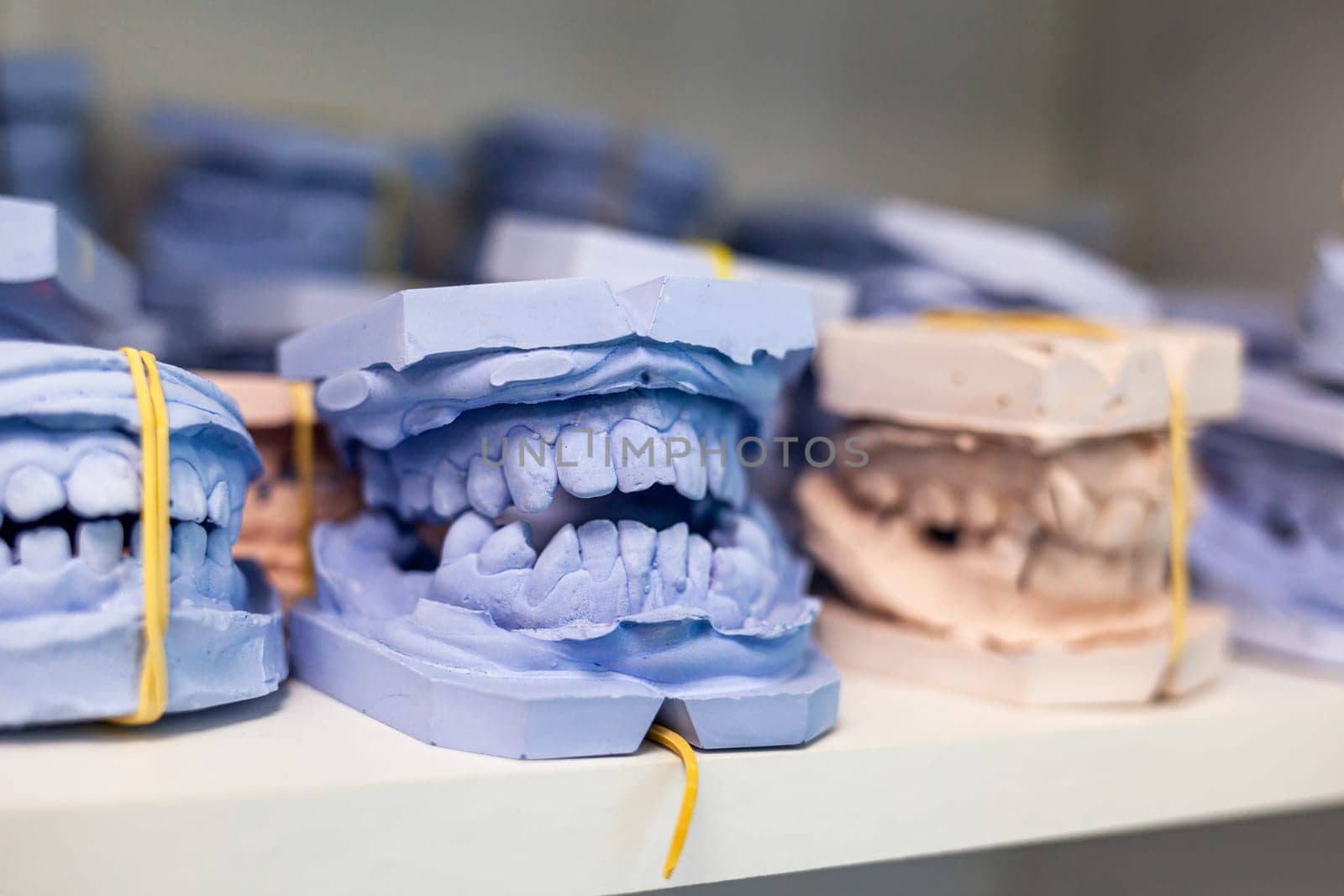 Shelf with lying on her casts of teeth and prosthetic and restorations by AnatoliiFoto