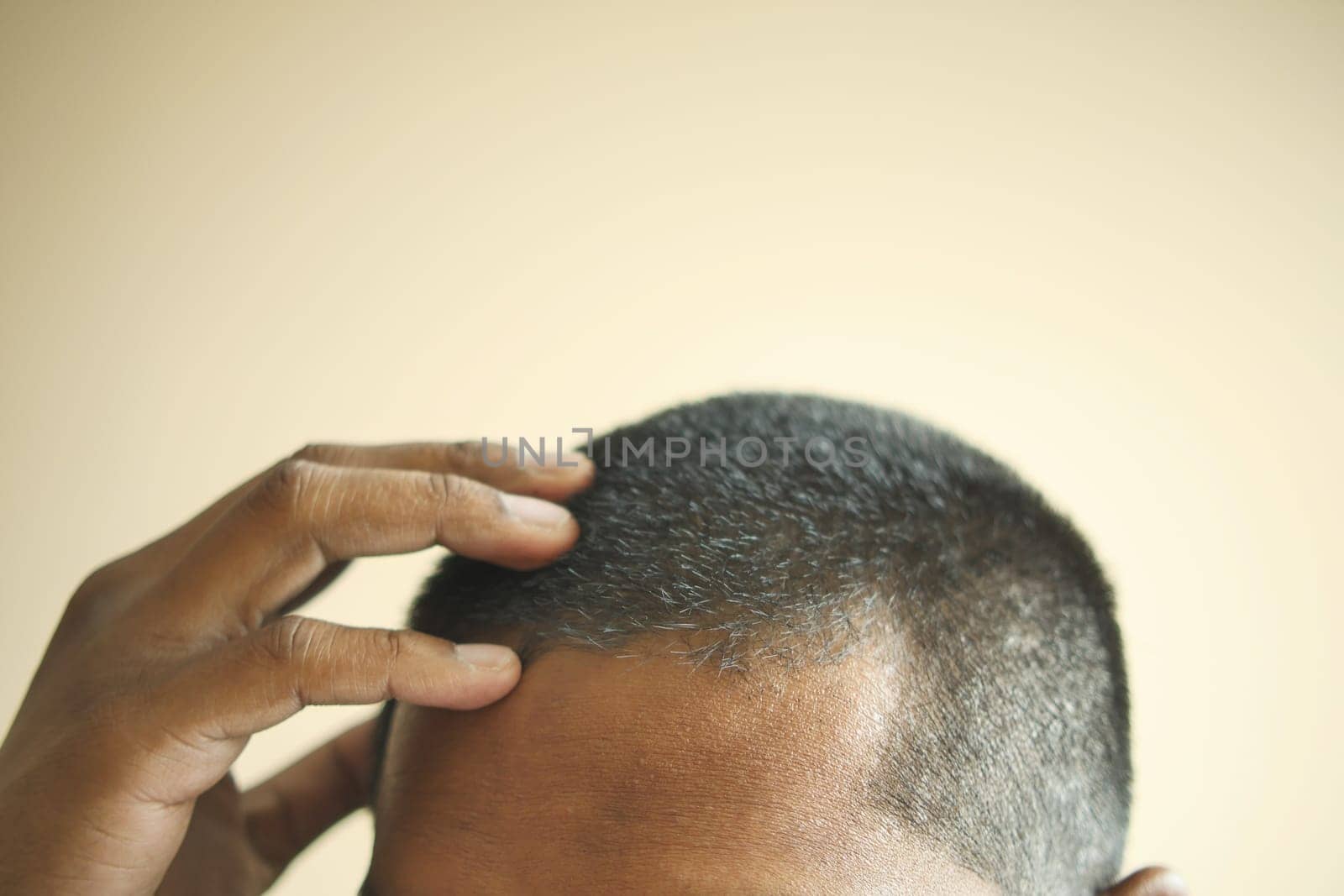 hair loss concept with man checking his hair .