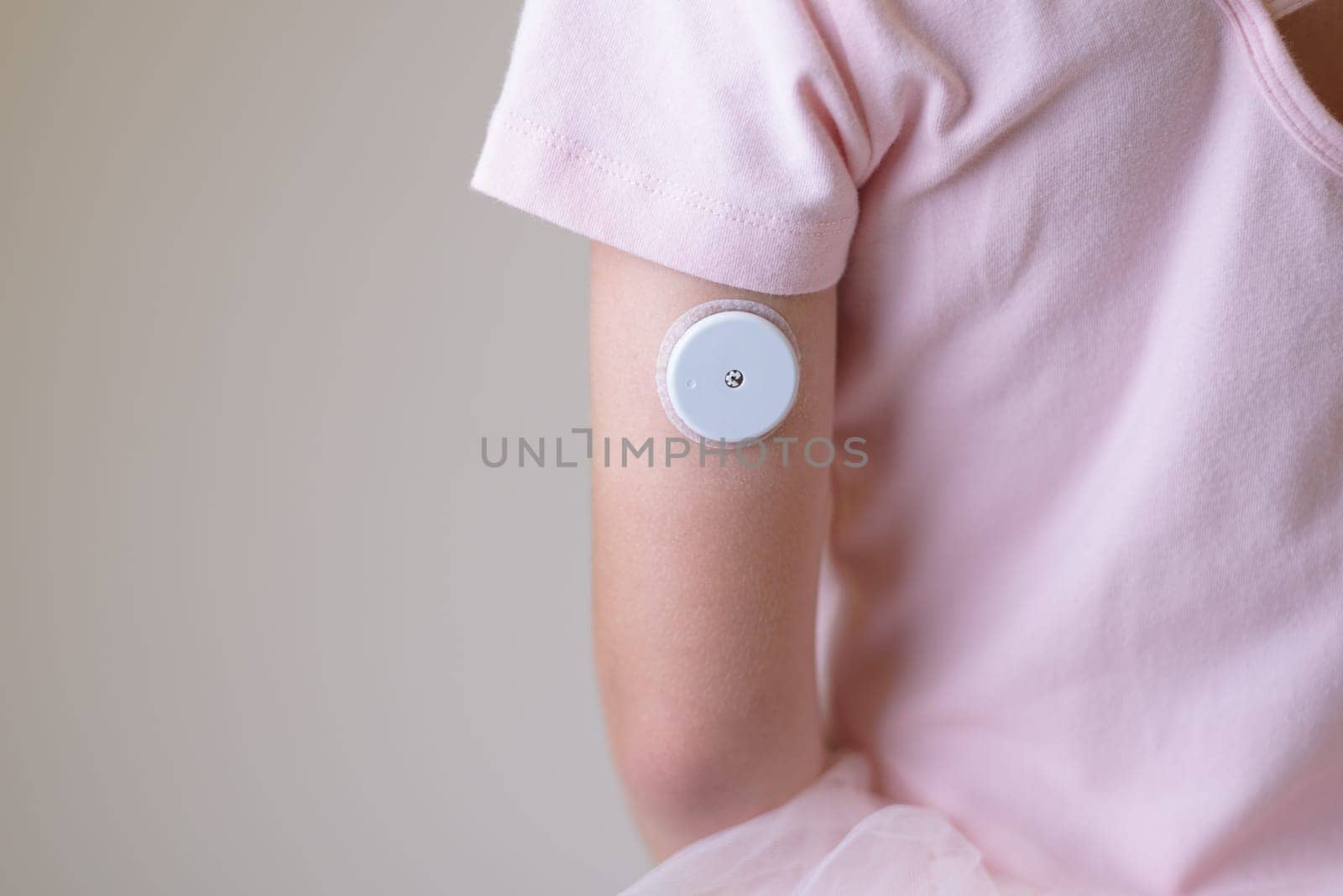 Blood glucose sensor on the arm of a child. Sensor for remote measurement of blood glucose levels using NFC technology on a mobile phone or reader.