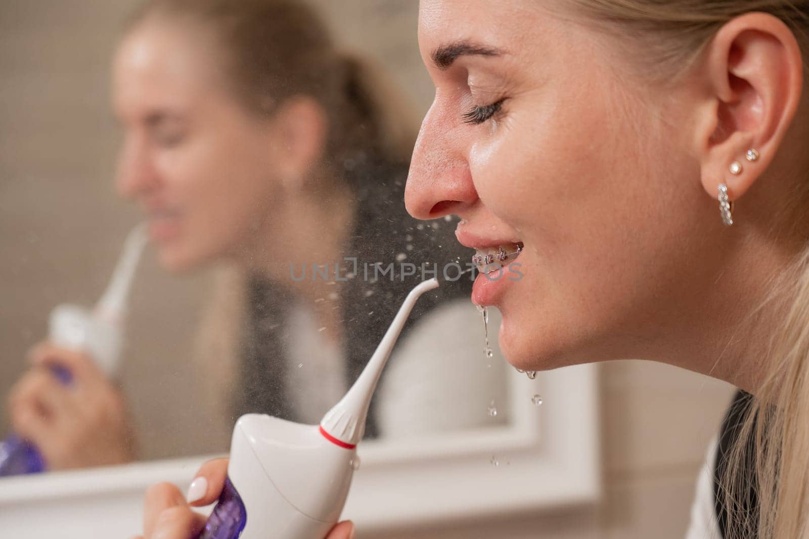 A woman with braces on her teeth uses an irrigator. Close-up portrait