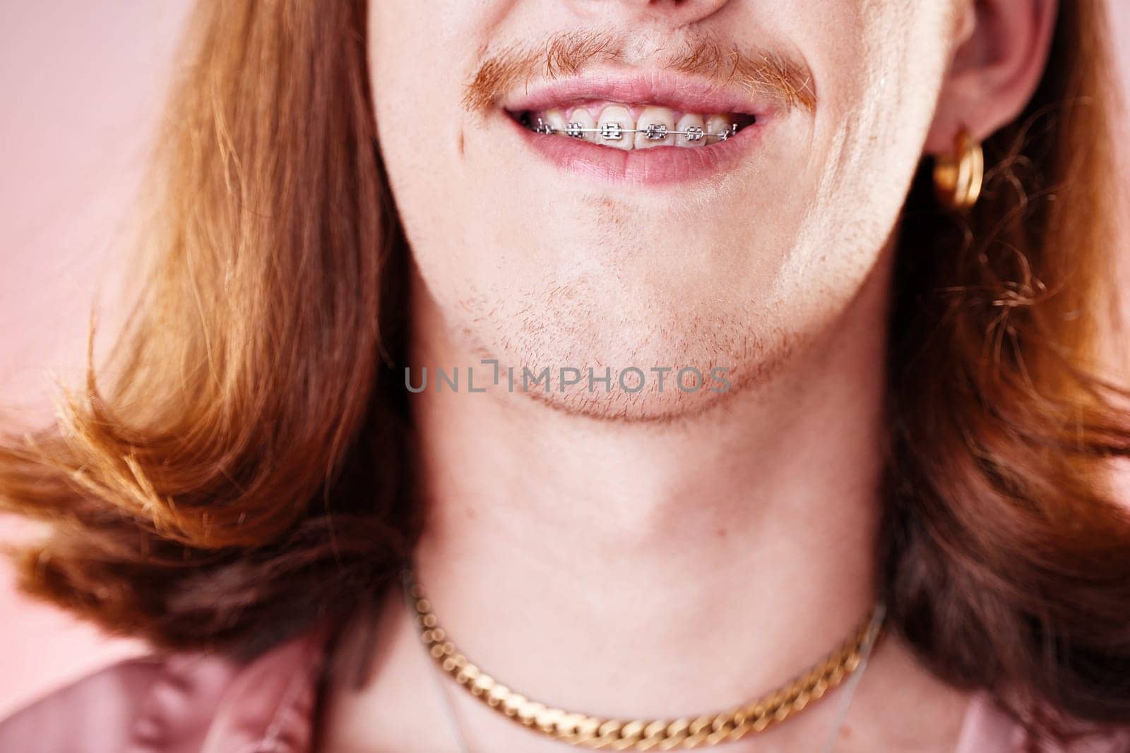 Face, teeth and smile with man in braces, orthodontics and beauty with cosmetics and healthcare on pink background. Young, gen z and fashion, oral care and mouth zoom, dental and health insurance.