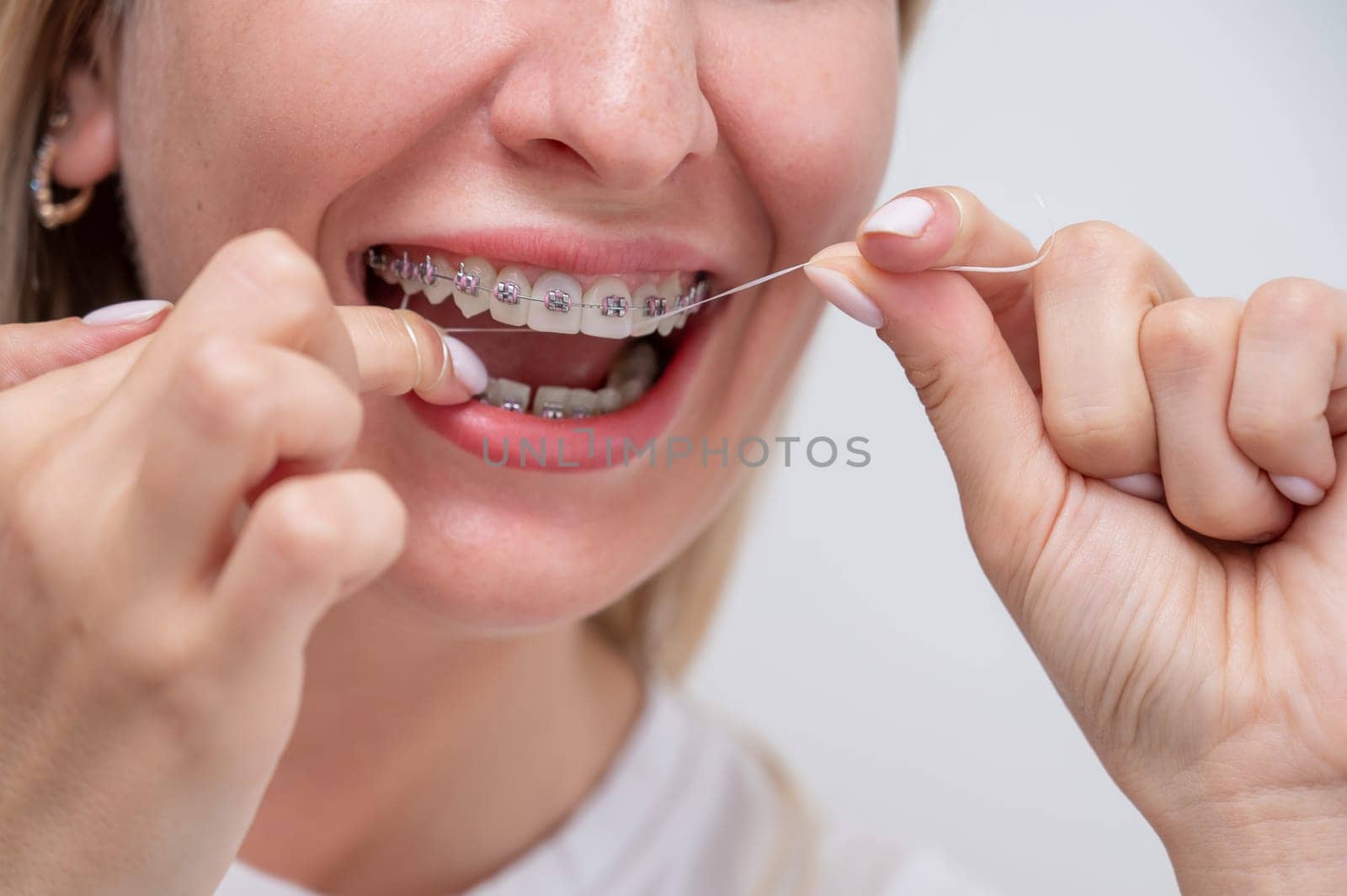 Caucasian woman cleaning her teeth with braces using dental floss. Cropped portrait