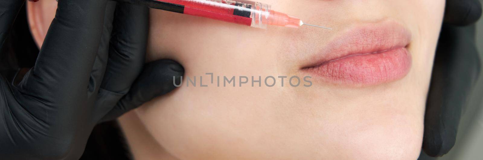 Beautiful woman gets an injection in lips