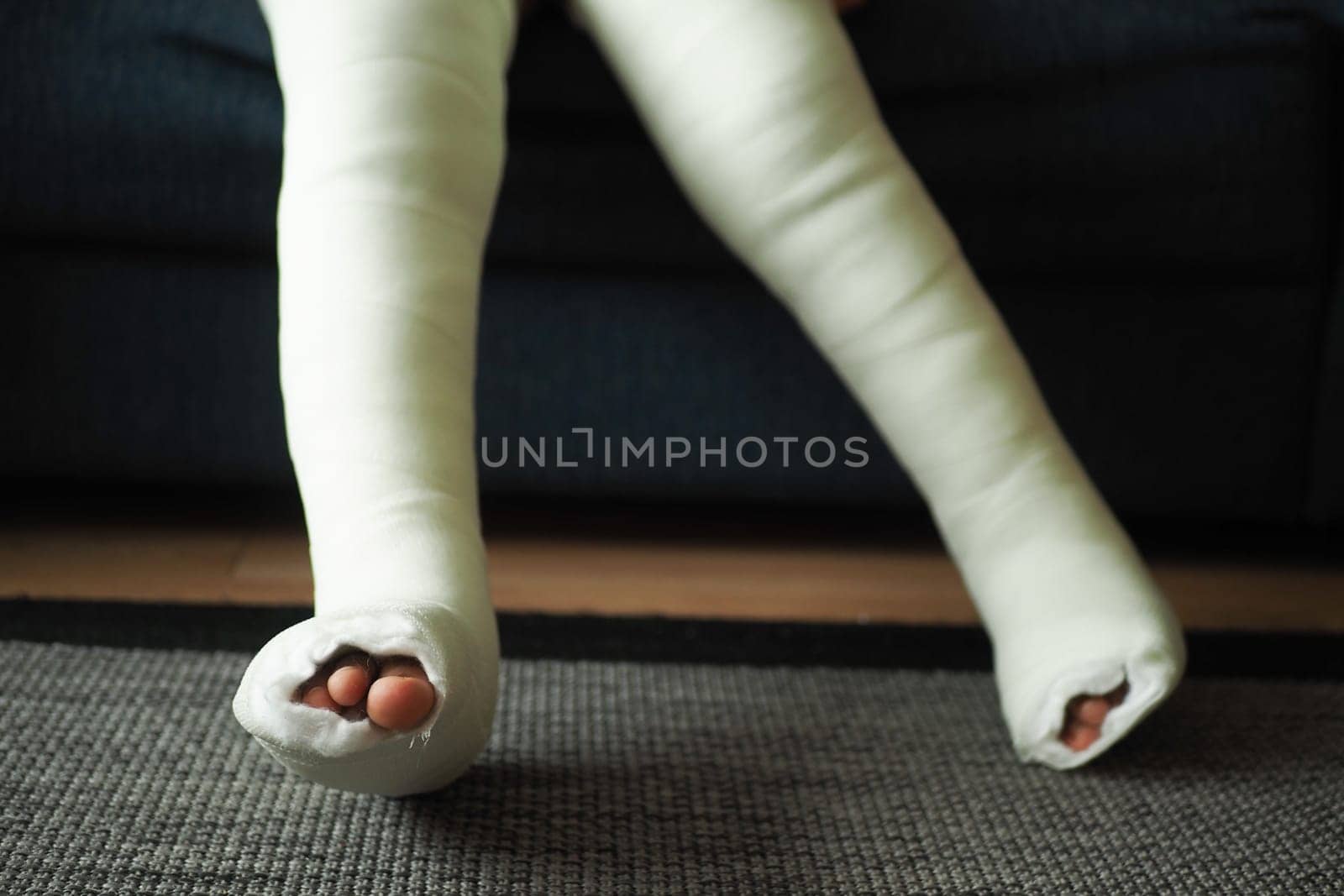 little child boy with plaster bandage on leg