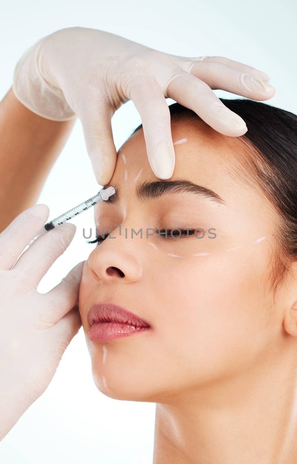 Skincare, woman and face syringe for plastic surgery in studio isolated on white background. Facial, injection and cosmetics of female model with collagen filler for dermatology, beauty or aesthetic