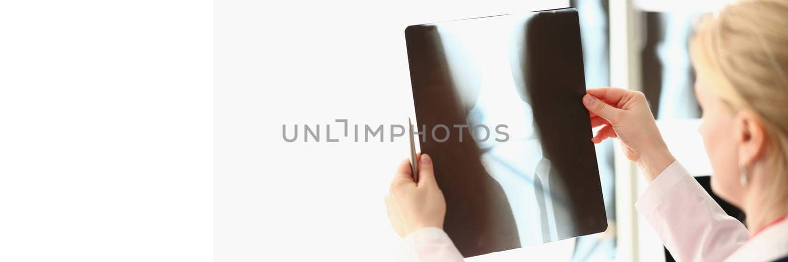 Doctor examines an x-ray of patient knee in clinic. Arthritis knee joint concept