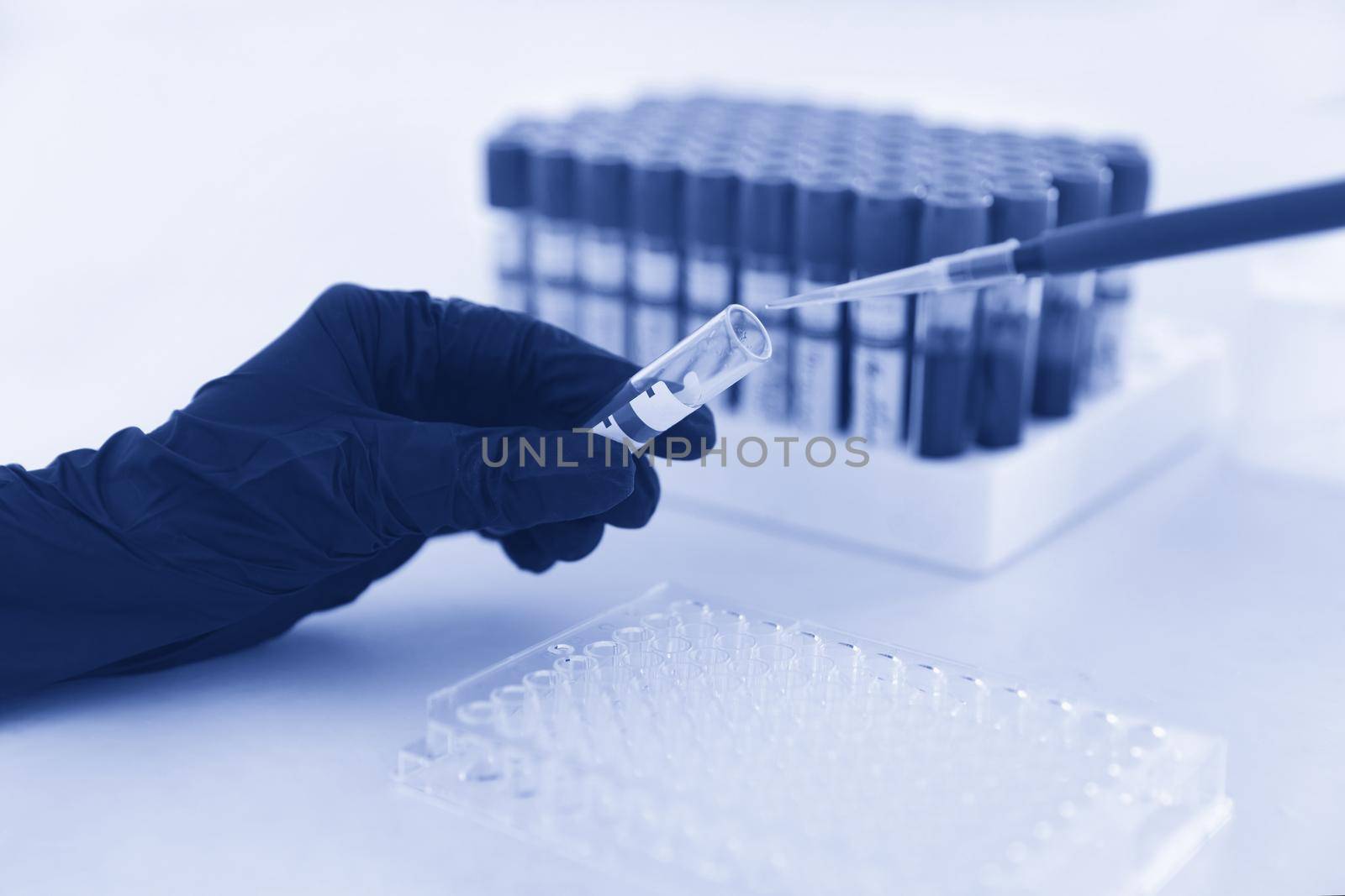 hands of a lab technician with a tube of blood sample and rack with other samples. lab technician holding blood tube sample for study