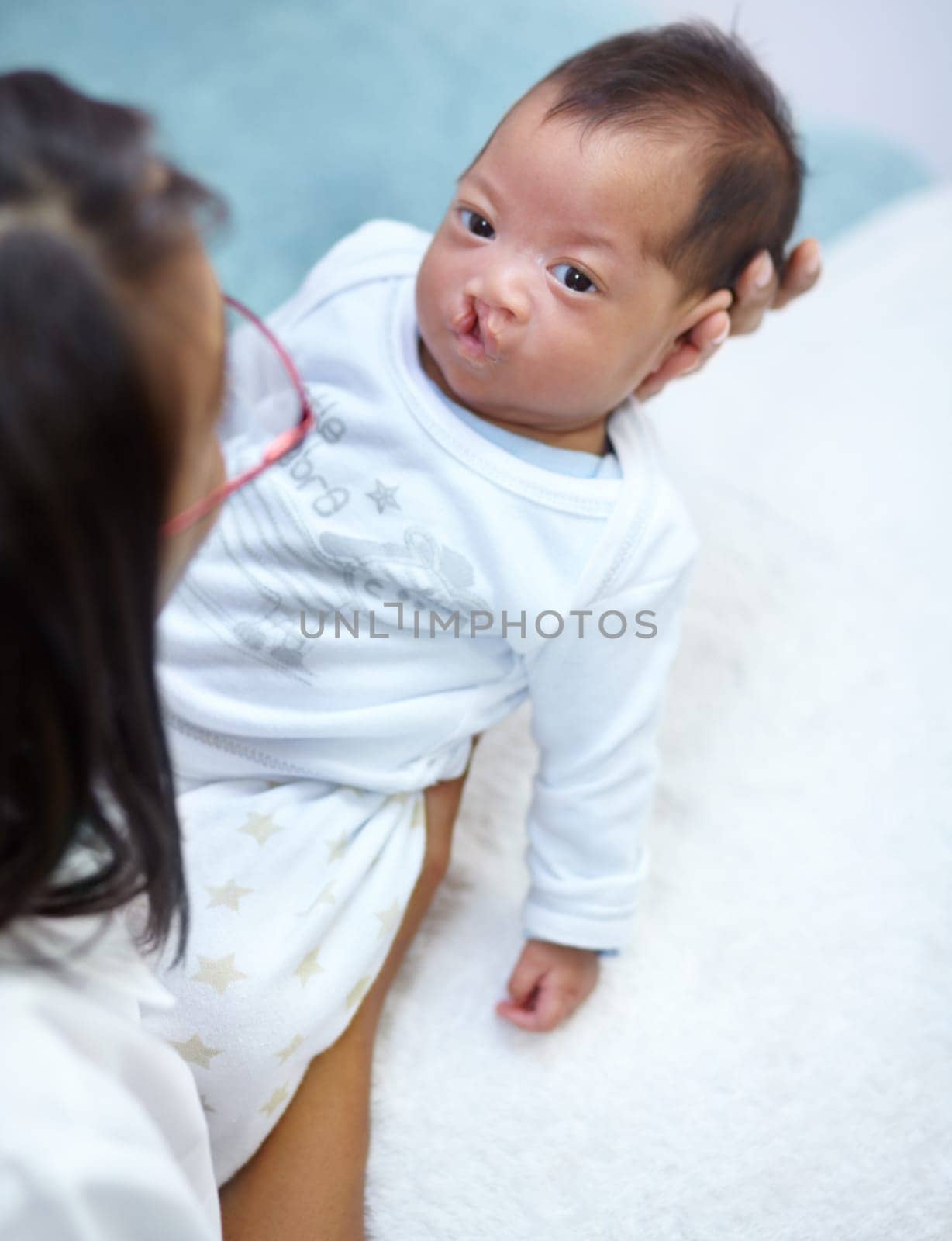 Family, mother and a baby with a cleft lip in the bedroom of their home together for love or care from above. Healthcare, medical and female child with a disability in the arms of her mama in a house by YuriArcurs