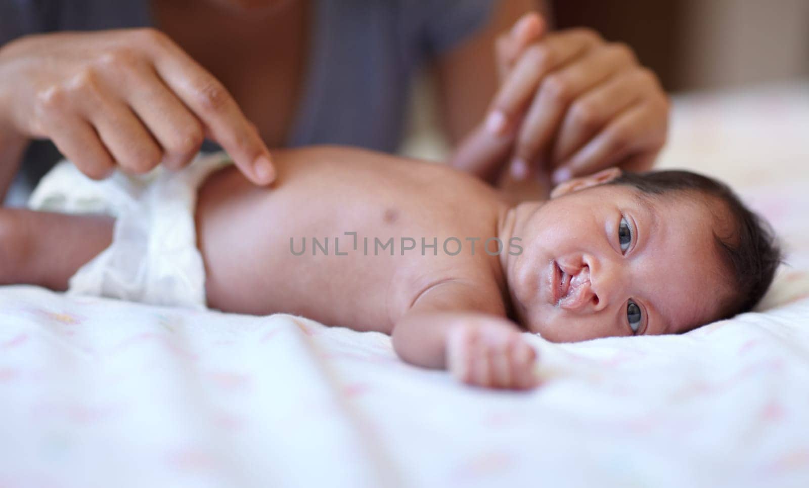 Care, portrait and a baby with a cleft palate being changed, playing and hands of a mother with love. Family, health and a newborn child with a disability and a mama or parent for childcare.