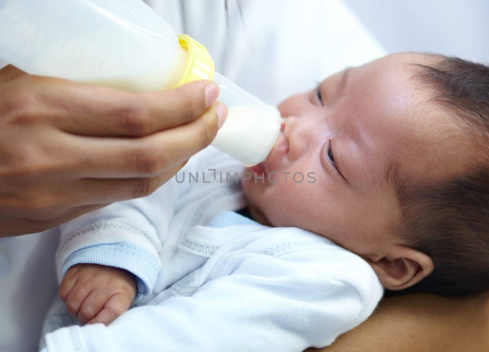 Baby with cleft lip, milk and mom feeding from bottle for nutrition, health and wellness. Formula, newborn and hand of mother feed child for development, growth or healthy diet, food or lunch at home by YuriArcurs