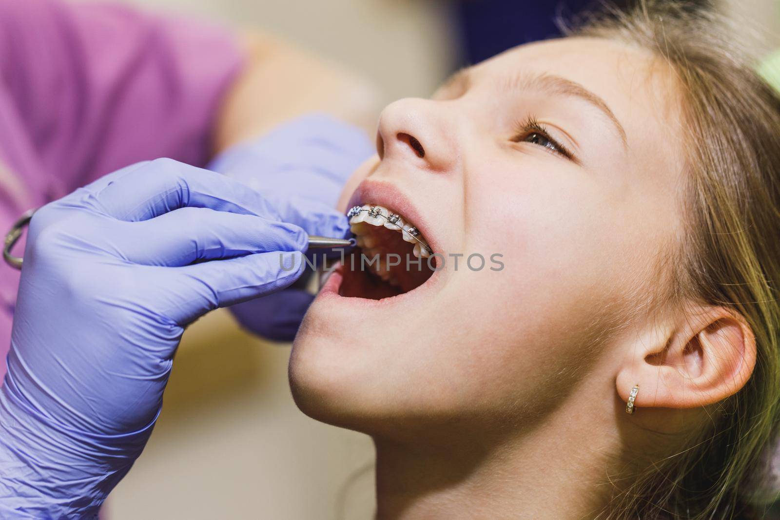 Teenage girl is at the dentist. She sits in the dentist's chair and the dentist sets braces on her teeth.