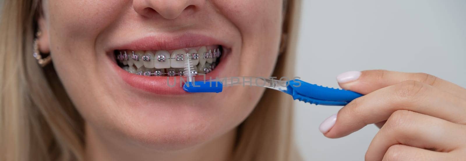 Caucasian woman cleaning her teeth with braces using a brush. Widescreen