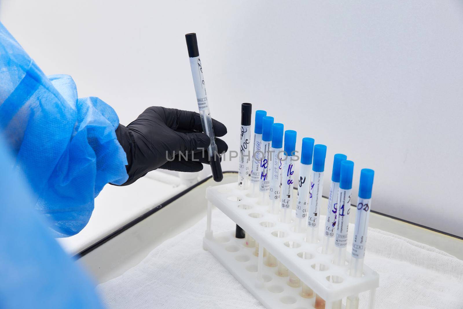 test tubes arranged on a tray in medical laboratory. Medical healthcare analysis in a hospital.