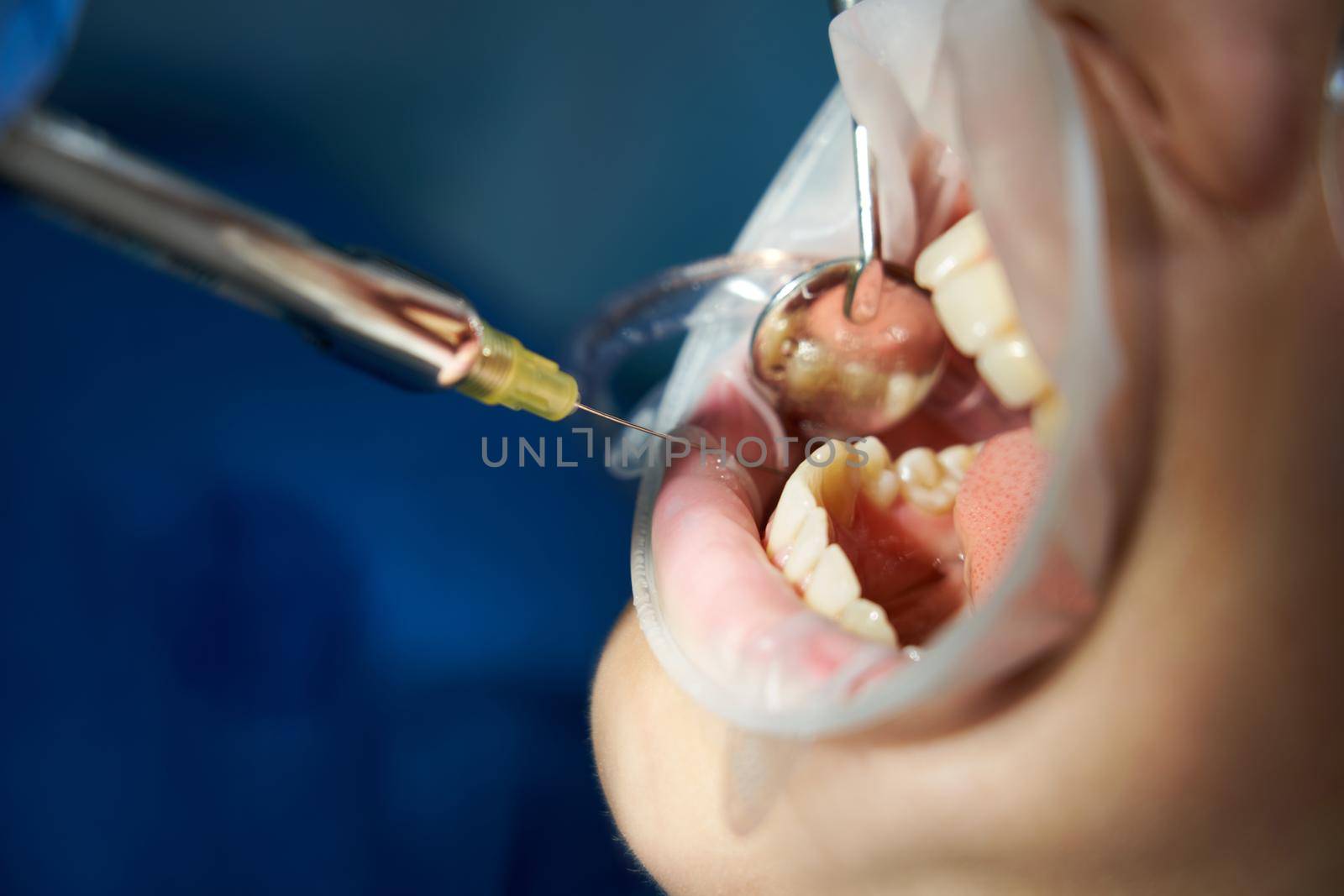 Patient visiting a dental office. Adult woman sitting in chair. Dentist hands in rubber protective gloves. Receiving anesthesia by syringe