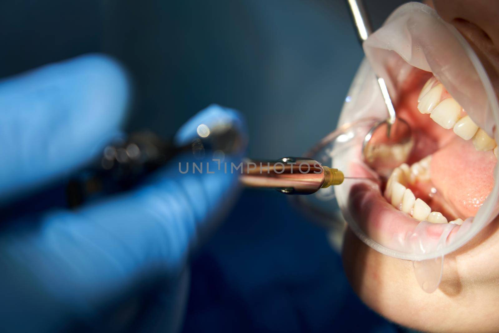 Patient visiting a dental office. Adult woman sitting in chair. Dentist hands in rubber protective gloves. Receiving anesthesia by syringe